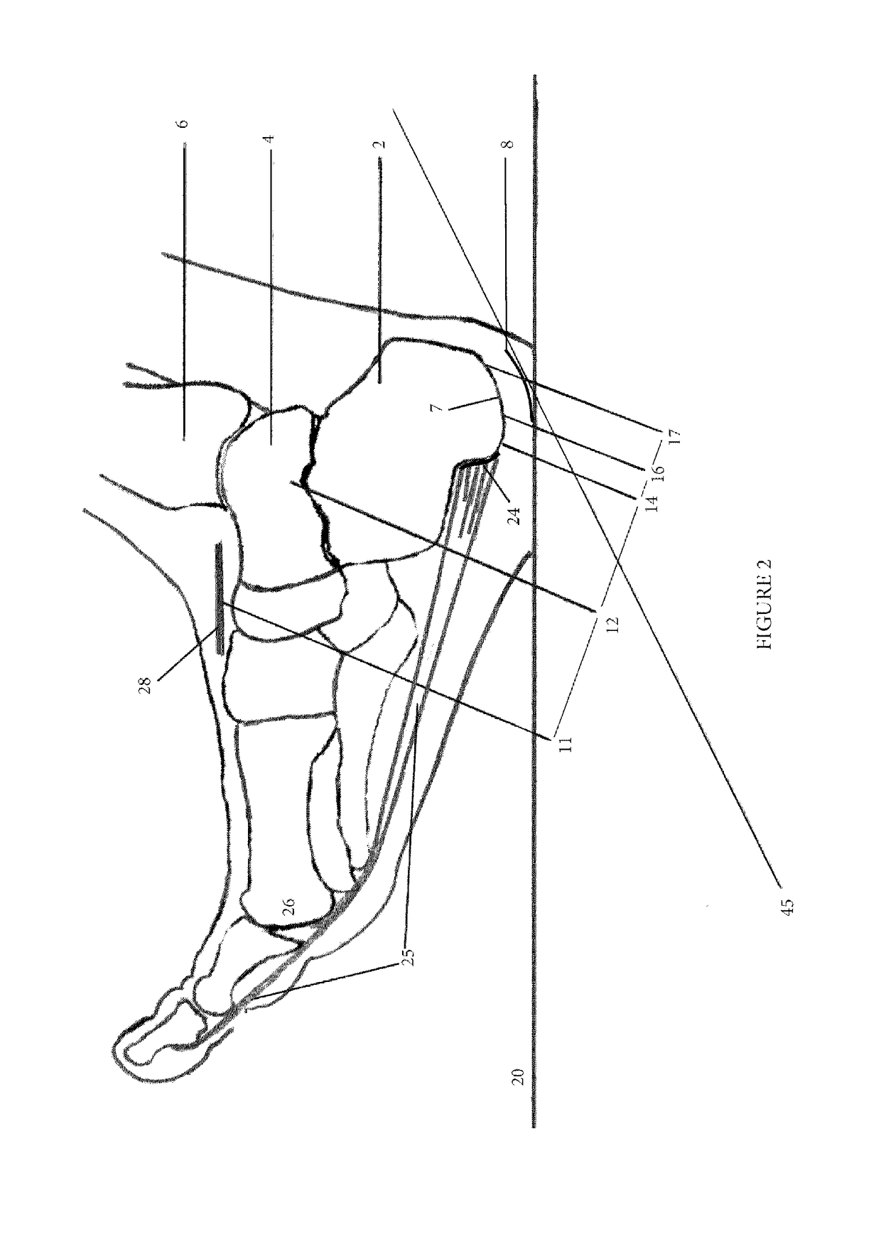 Footwear Heel Design