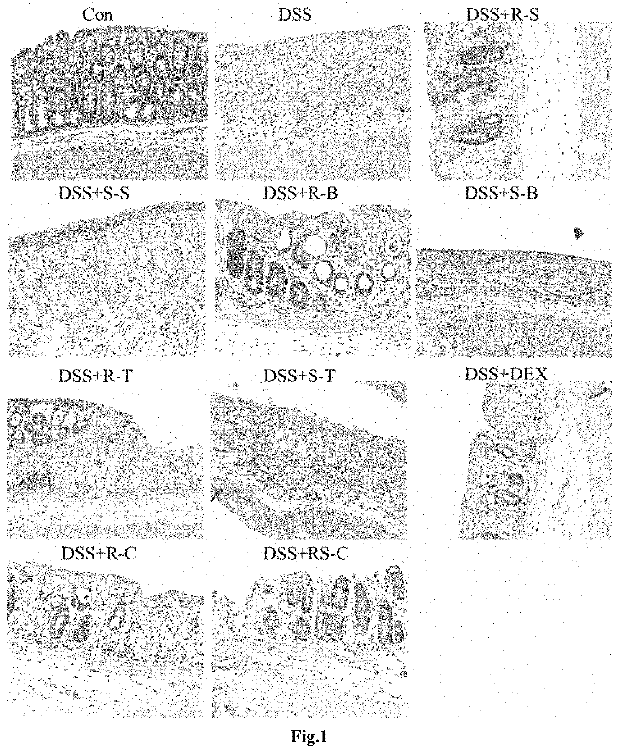 New use of R-enantiomer of adrenergic beta 2 receptor agonists for treatment of inflammatory bowel disease and its extra intestinal manifestations