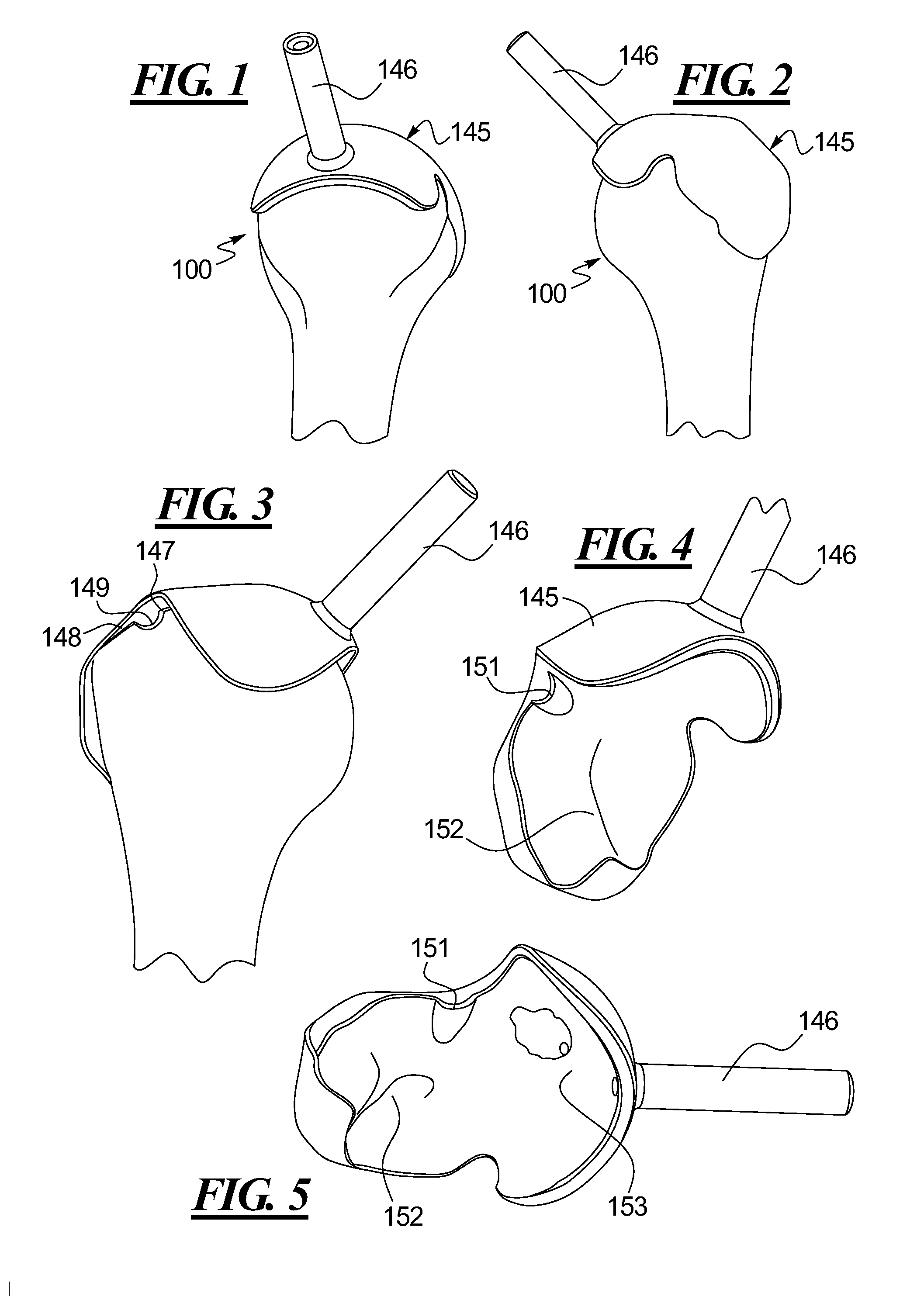 Methods and devices for installing standard and reverse shoulder implants