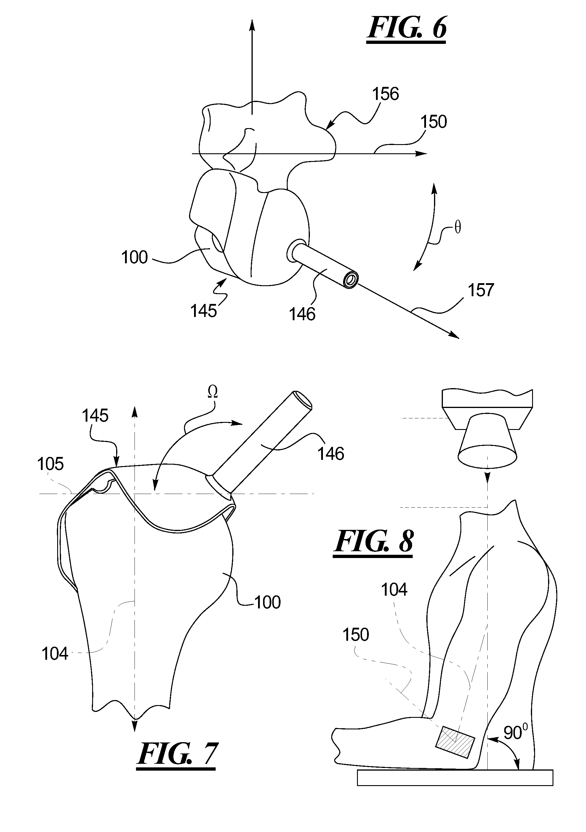 Methods and devices for installing standard and reverse shoulder implants
