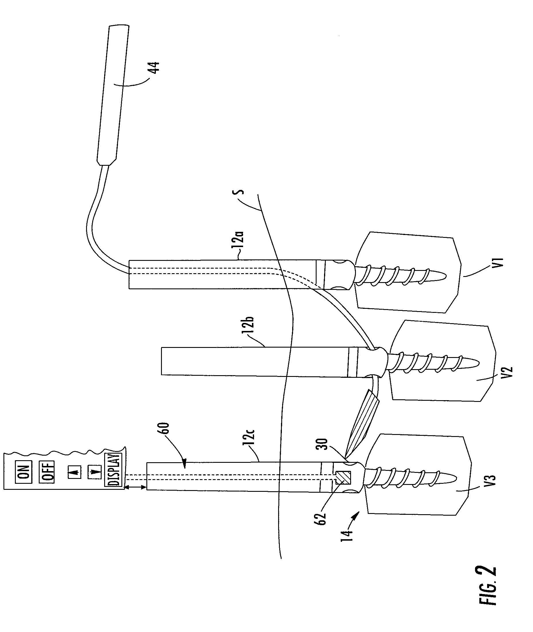 Magnetic Targeting System And Method Of Using The Same