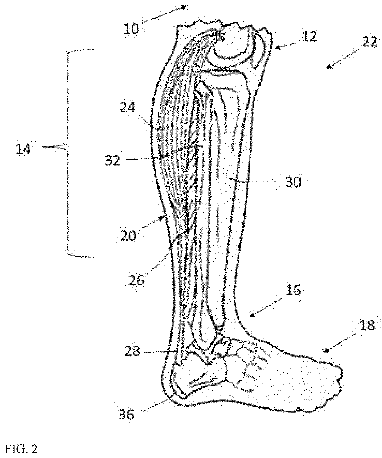 Dorsiflexion/plantarflexion extension above the knee brace