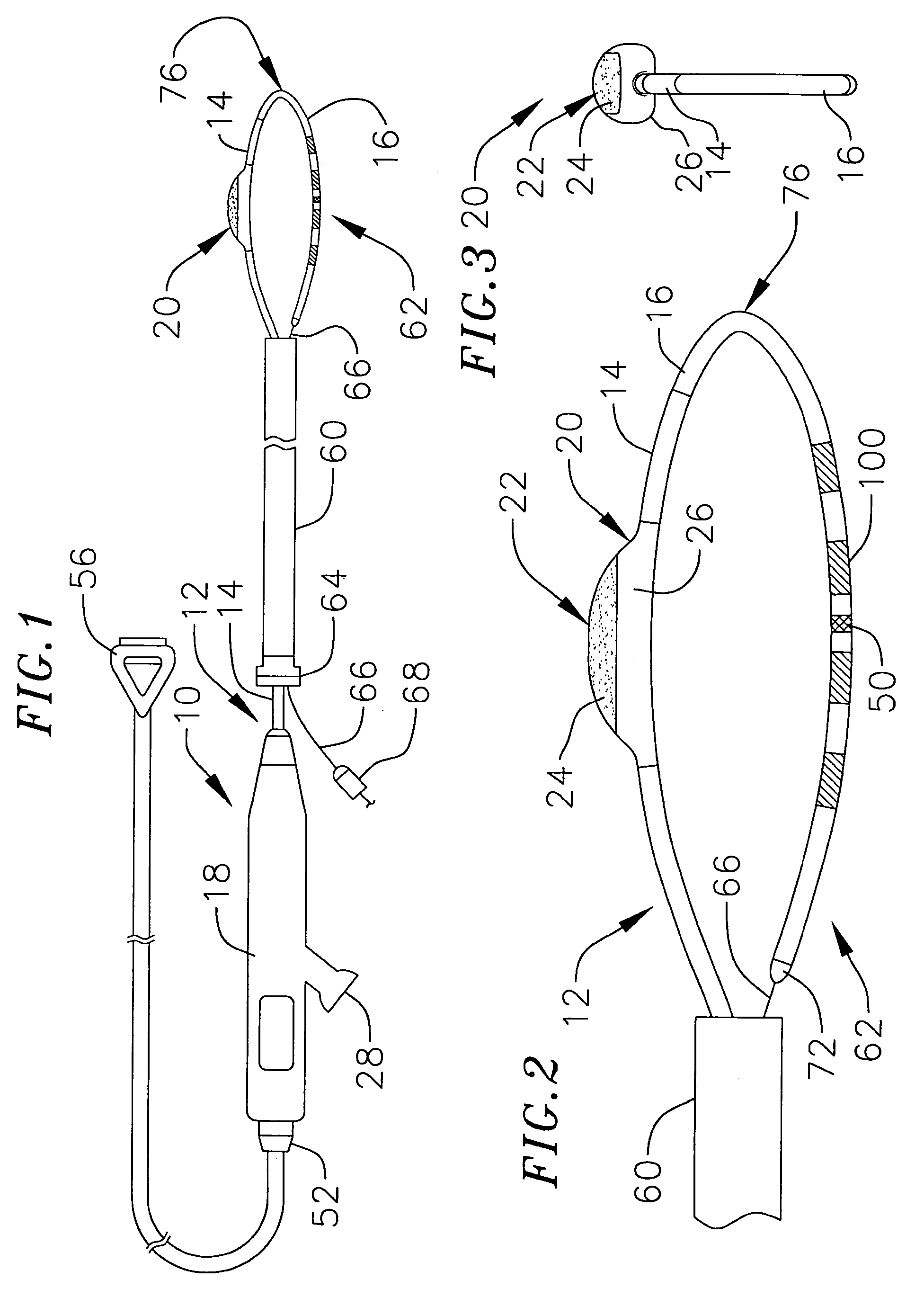 Loop structure including inflatable therapeutic device