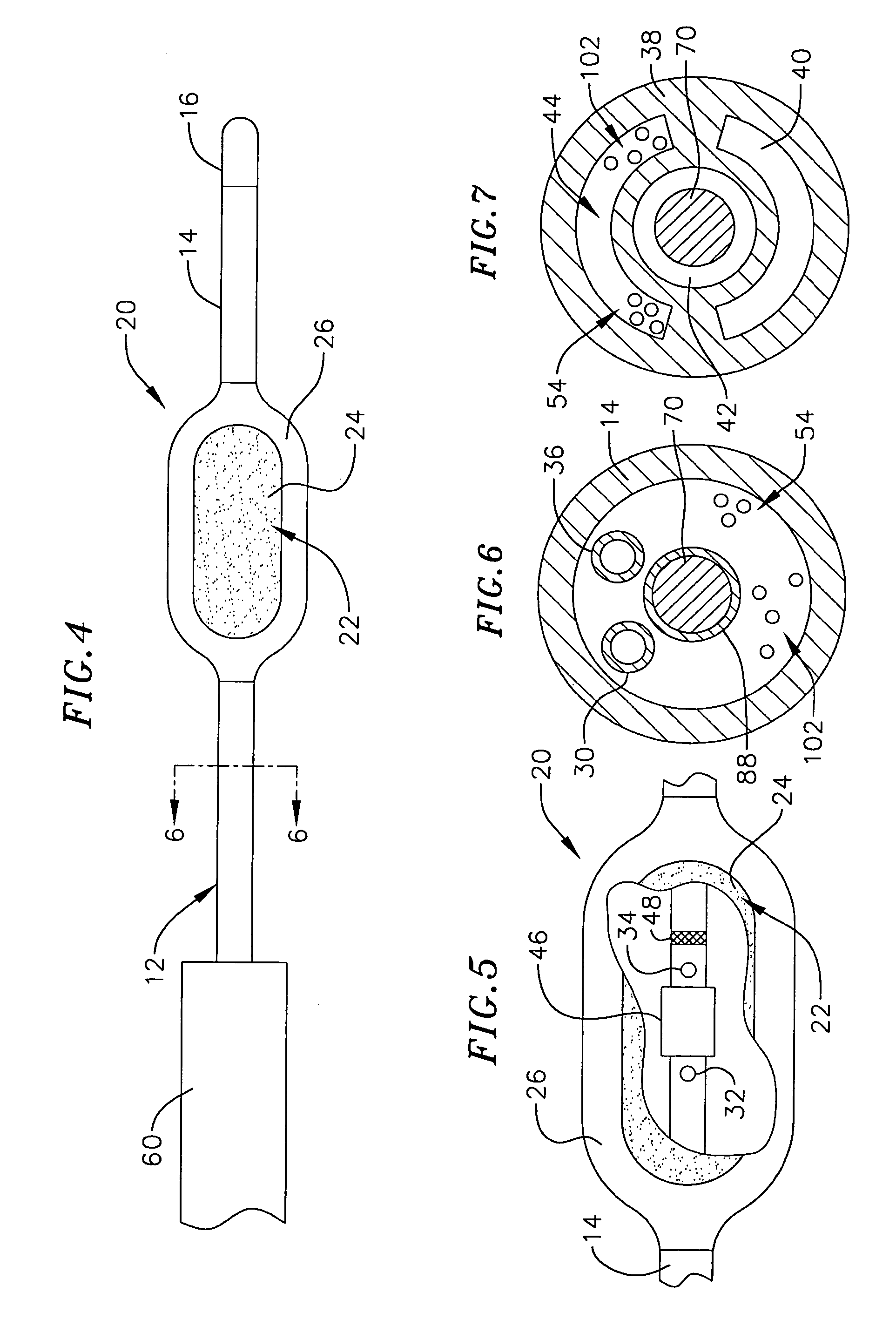 Loop structure including inflatable therapeutic device
