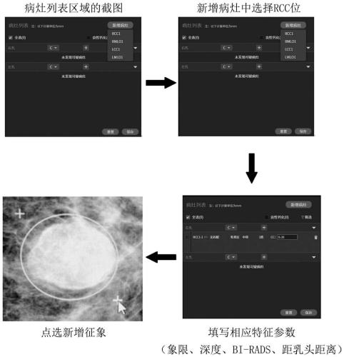 Gland medical image display method, interaction method, and storage medium