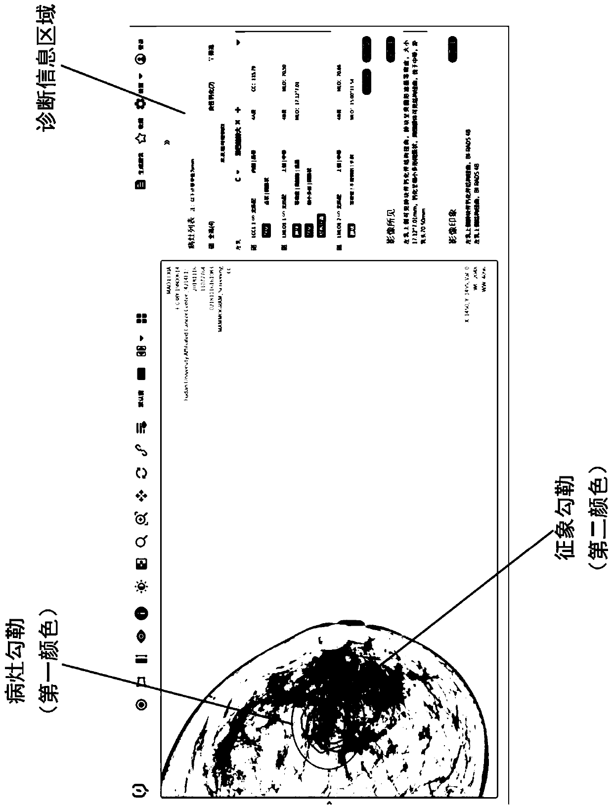 Gland medical image display method, interaction method, and storage medium