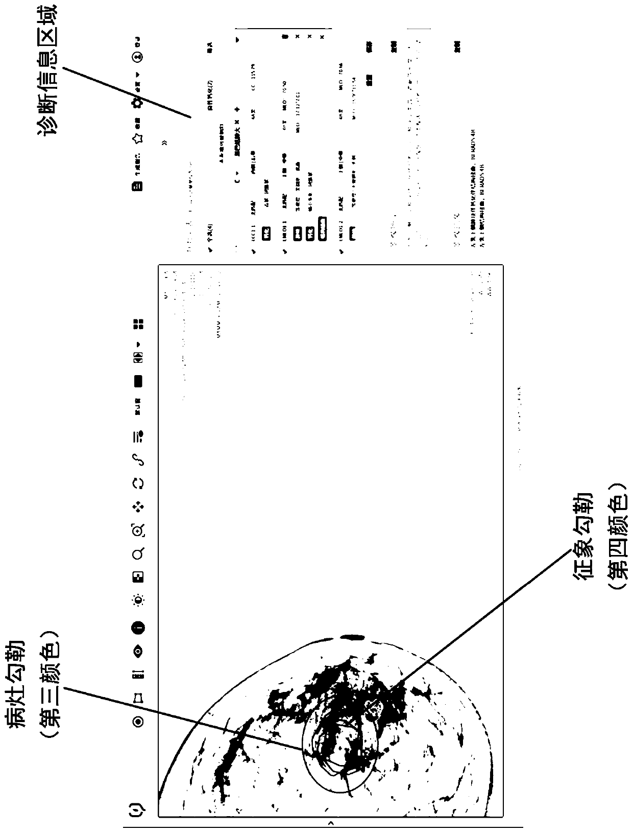 Gland medical image display method, interaction method, and storage medium