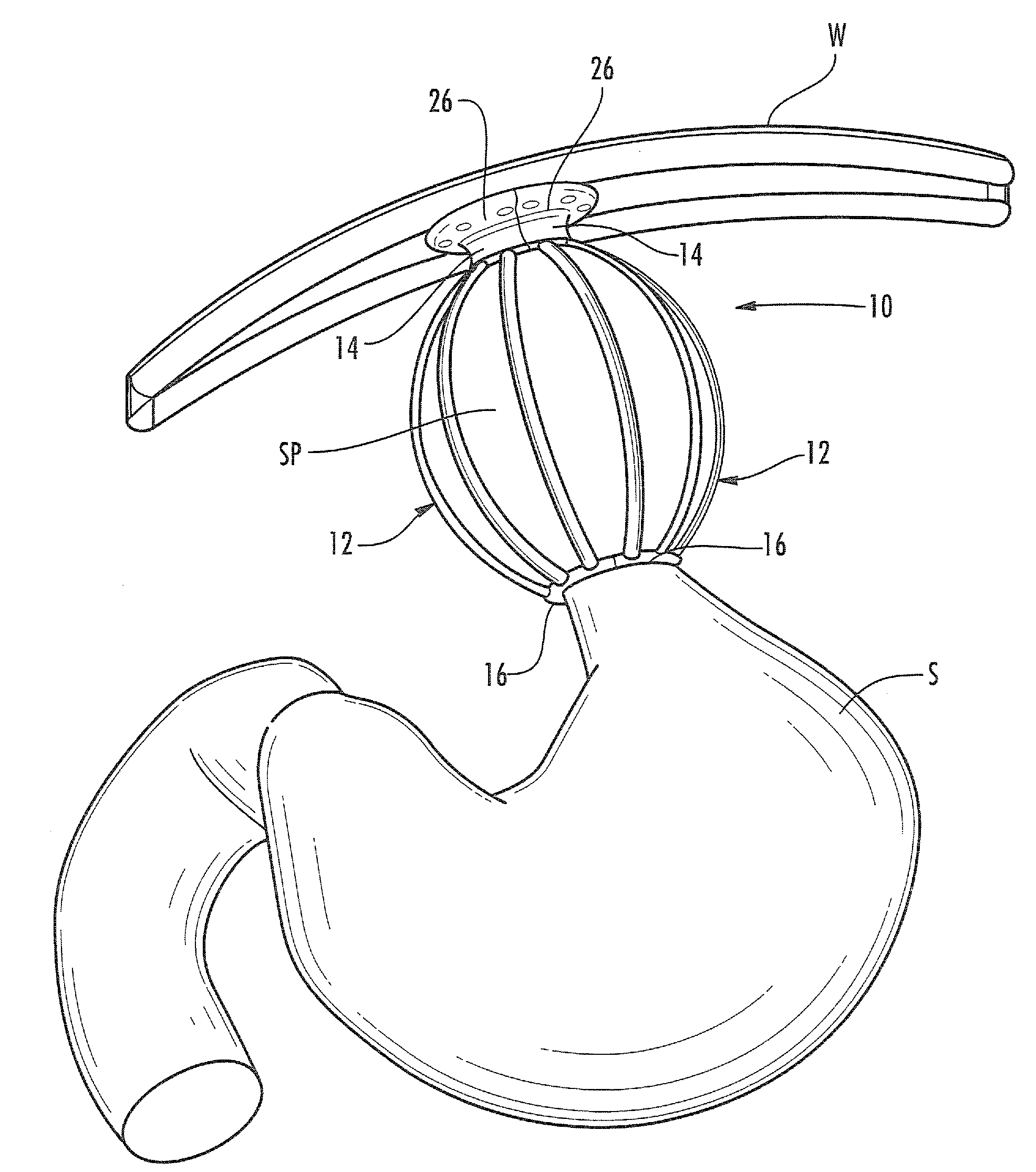 Satiation devices and methods for controlling obesity