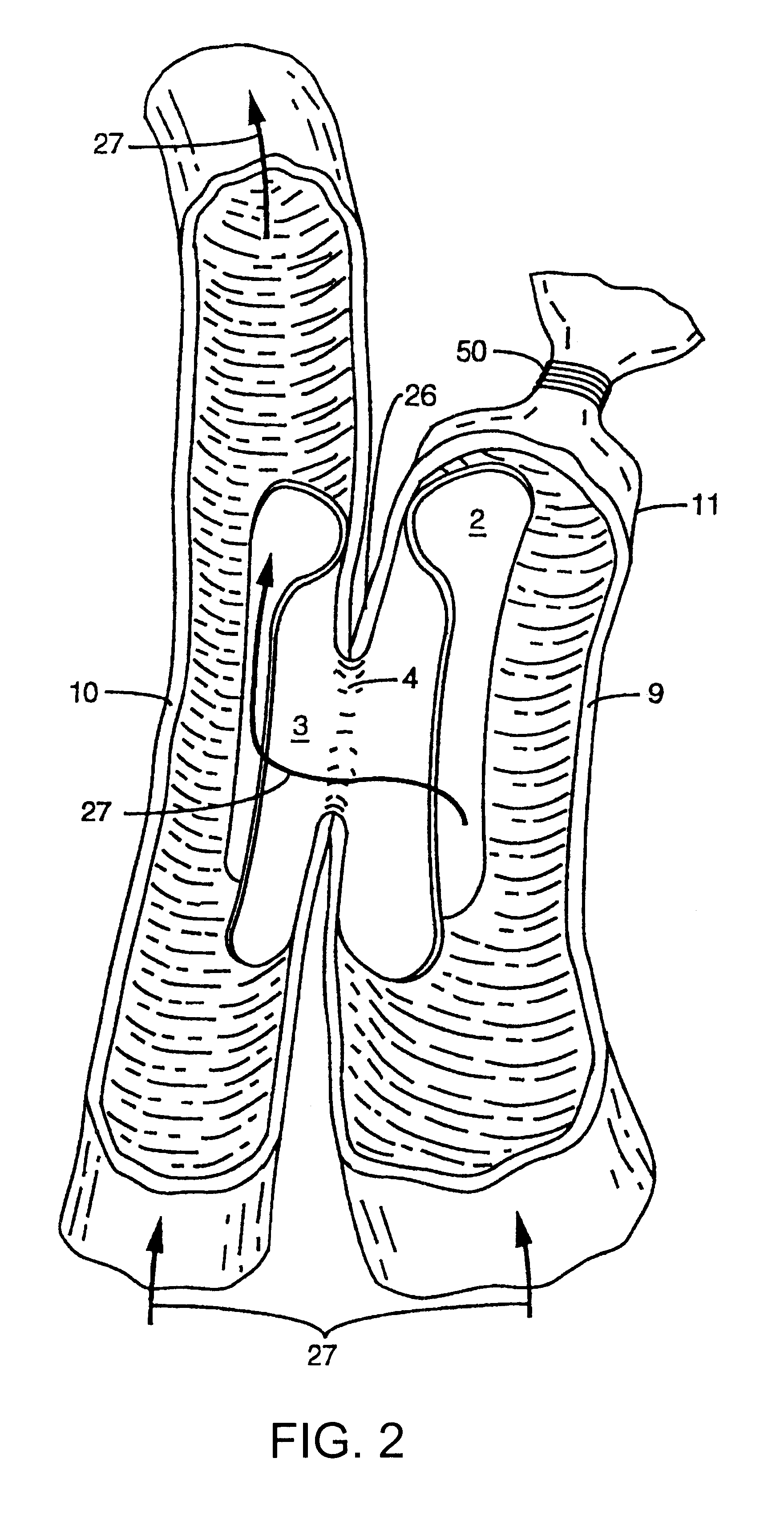 Devices and methods for interconnecting vessels