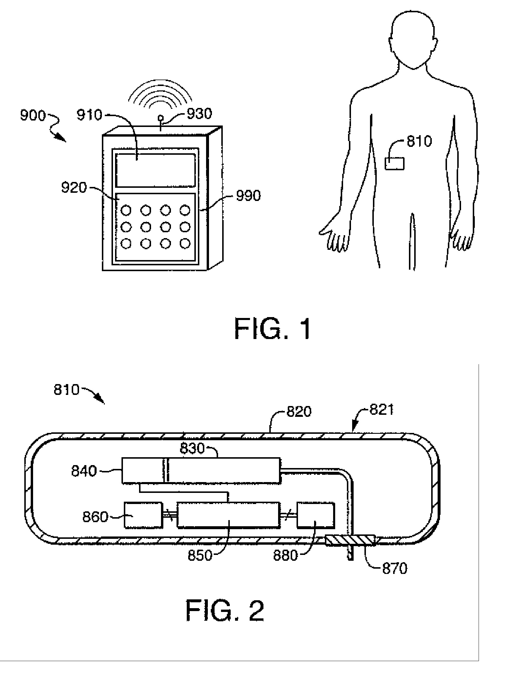 Transcutaneous fluid delivery system
