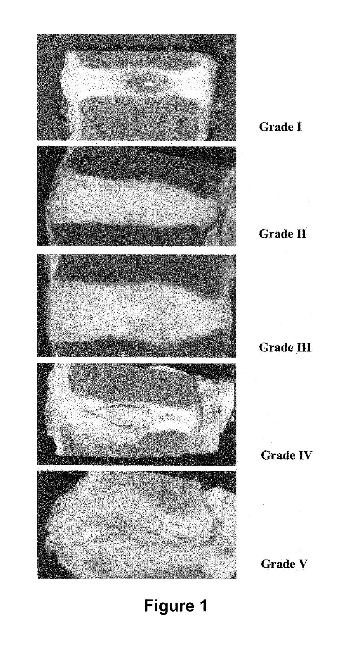 Compositions and Methods for Treating a Disorder or Defect in Soft Tissue