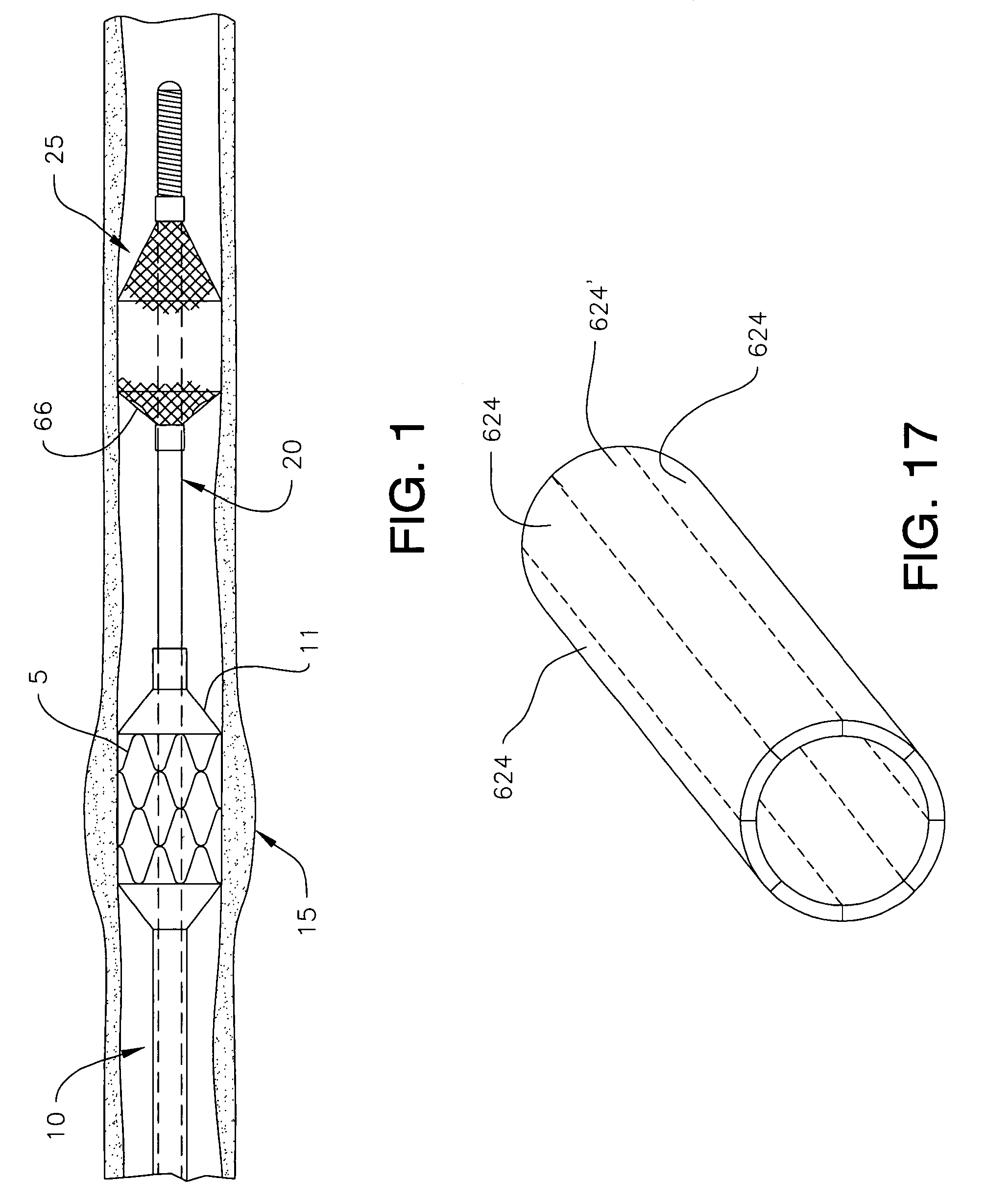 Steerable distal protection guidewire and methods of use
