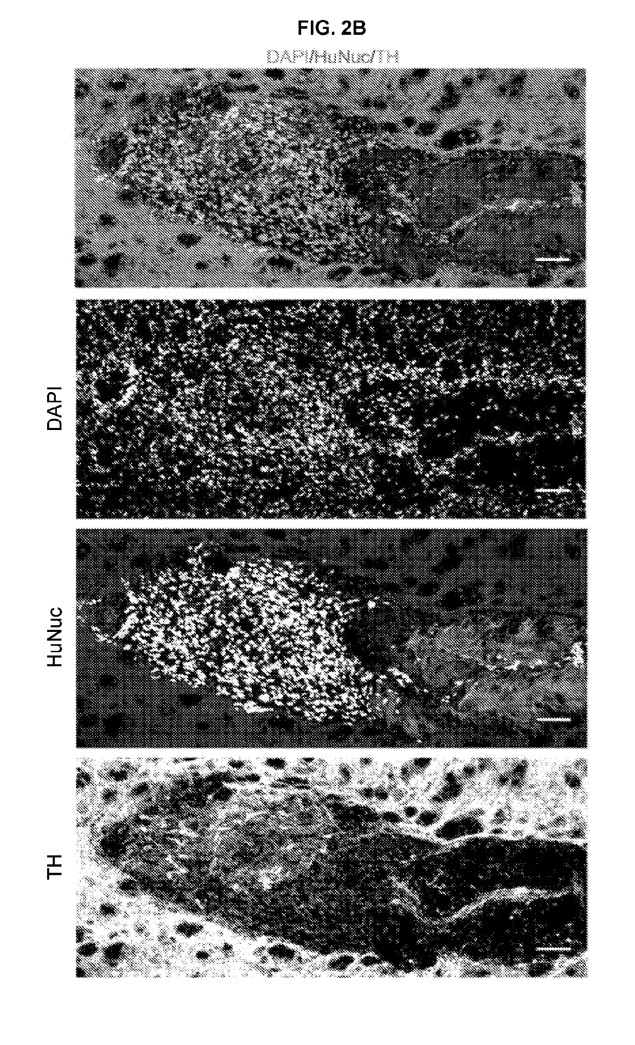 Cellularized hydrogels and methods of using the same