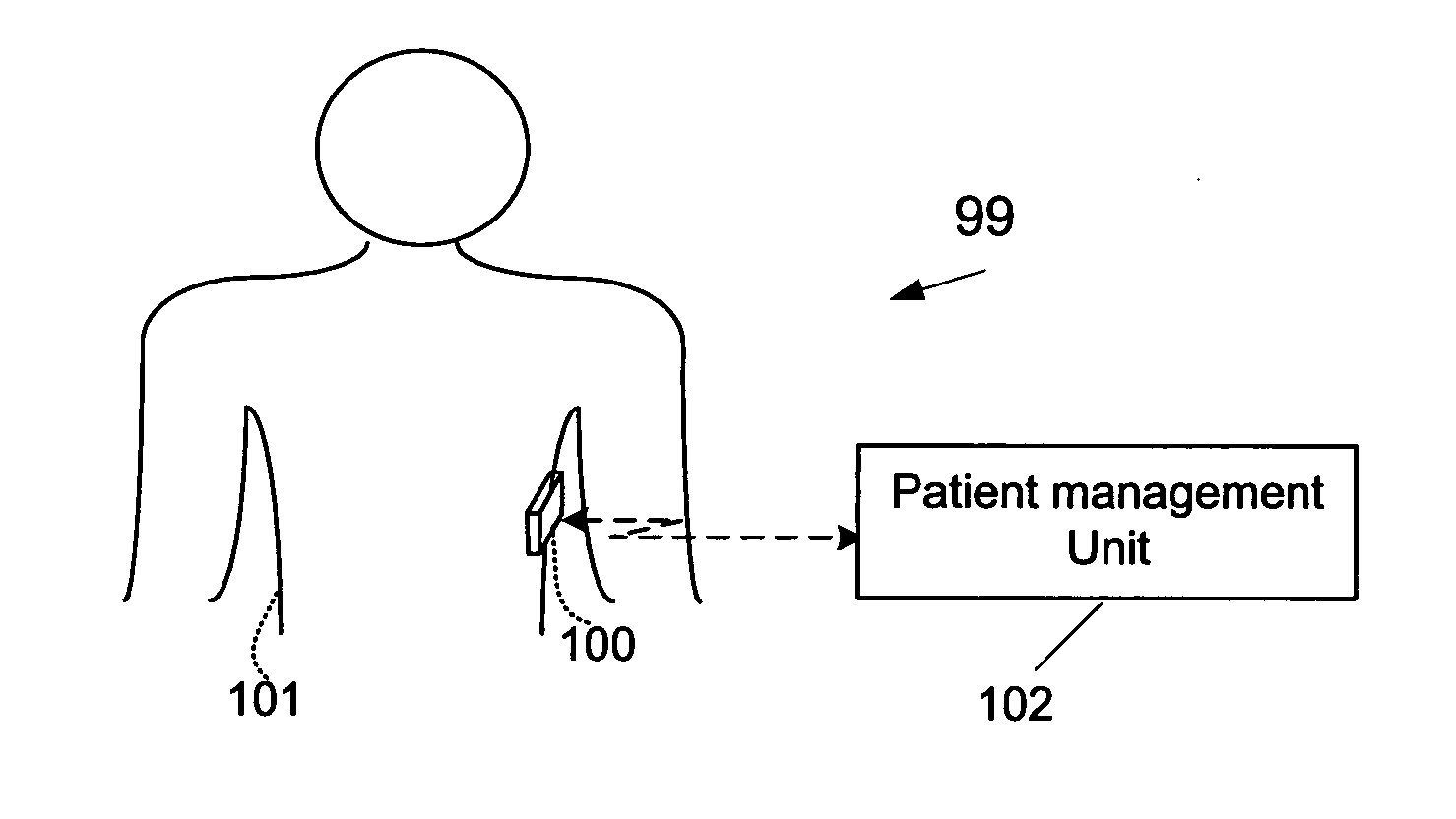 Method, system and apparatus for using electromagnetic radiation for monitoring a tissue of a user