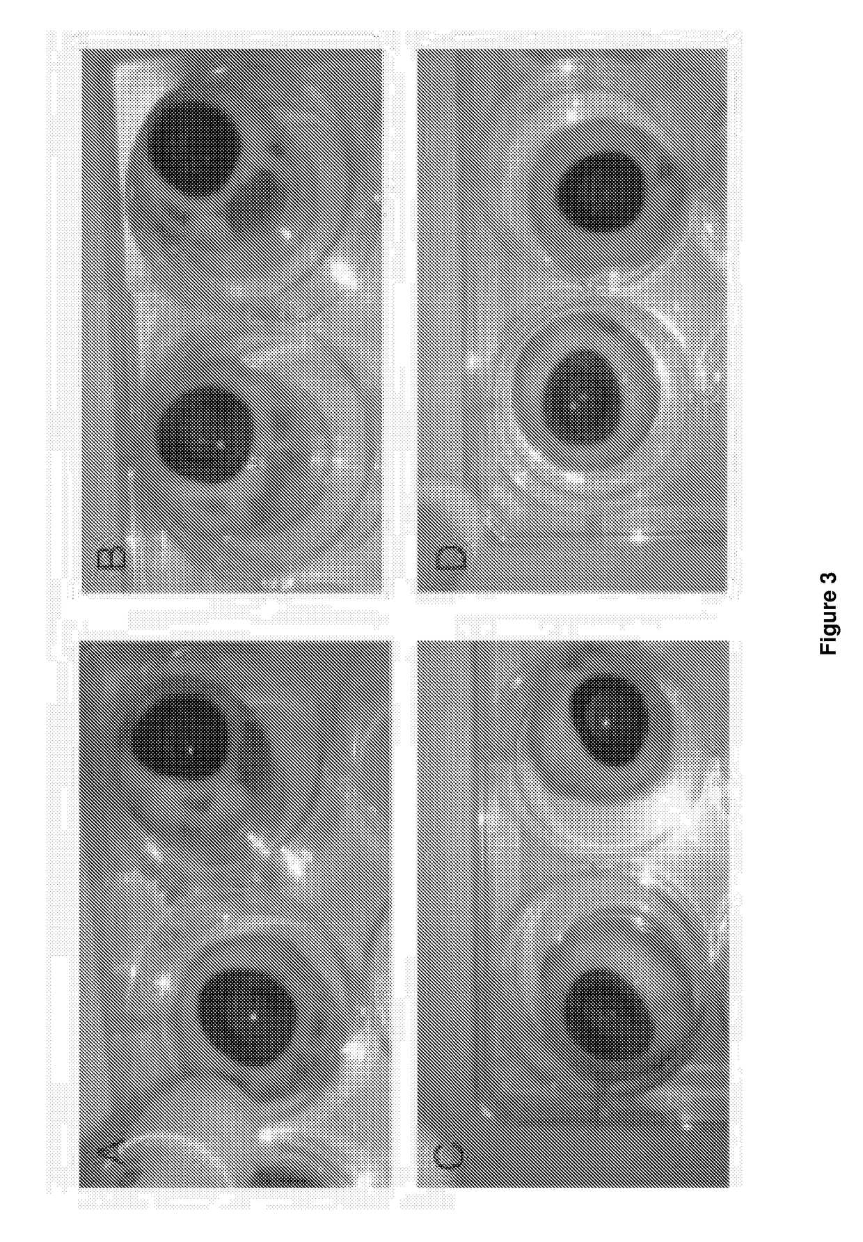 Composition comprising diacid derivatives and their use in the treatment of collagenic eye disorders