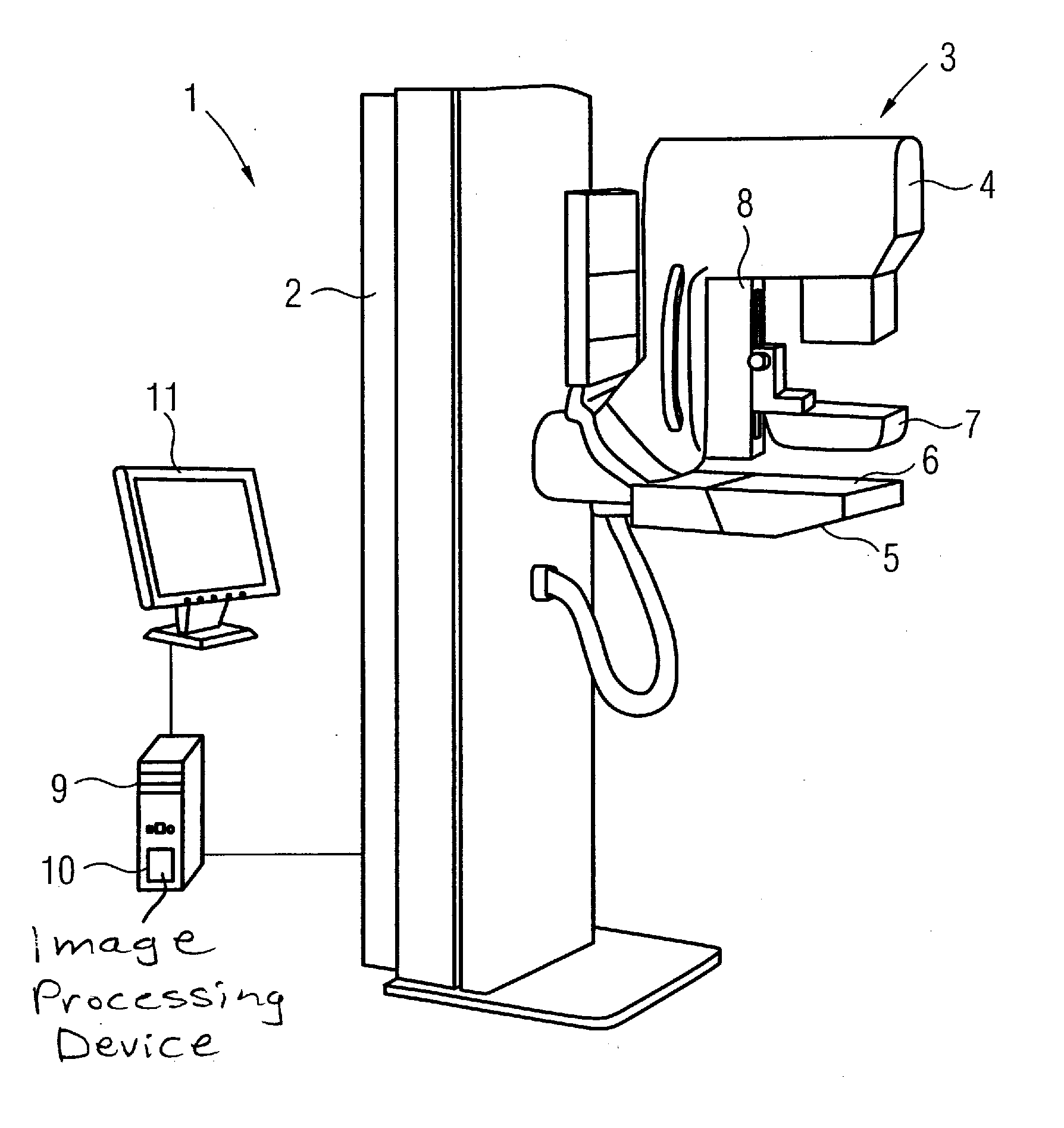 Mammography method and apparatus with image data obtained at different degrees of breast compression