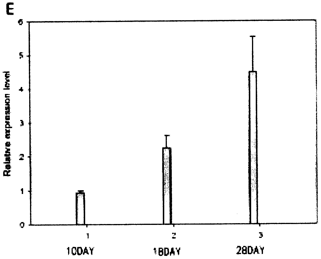 Regulation gene GmRSD in middle and later periods of soybean nodulation and application method thereof