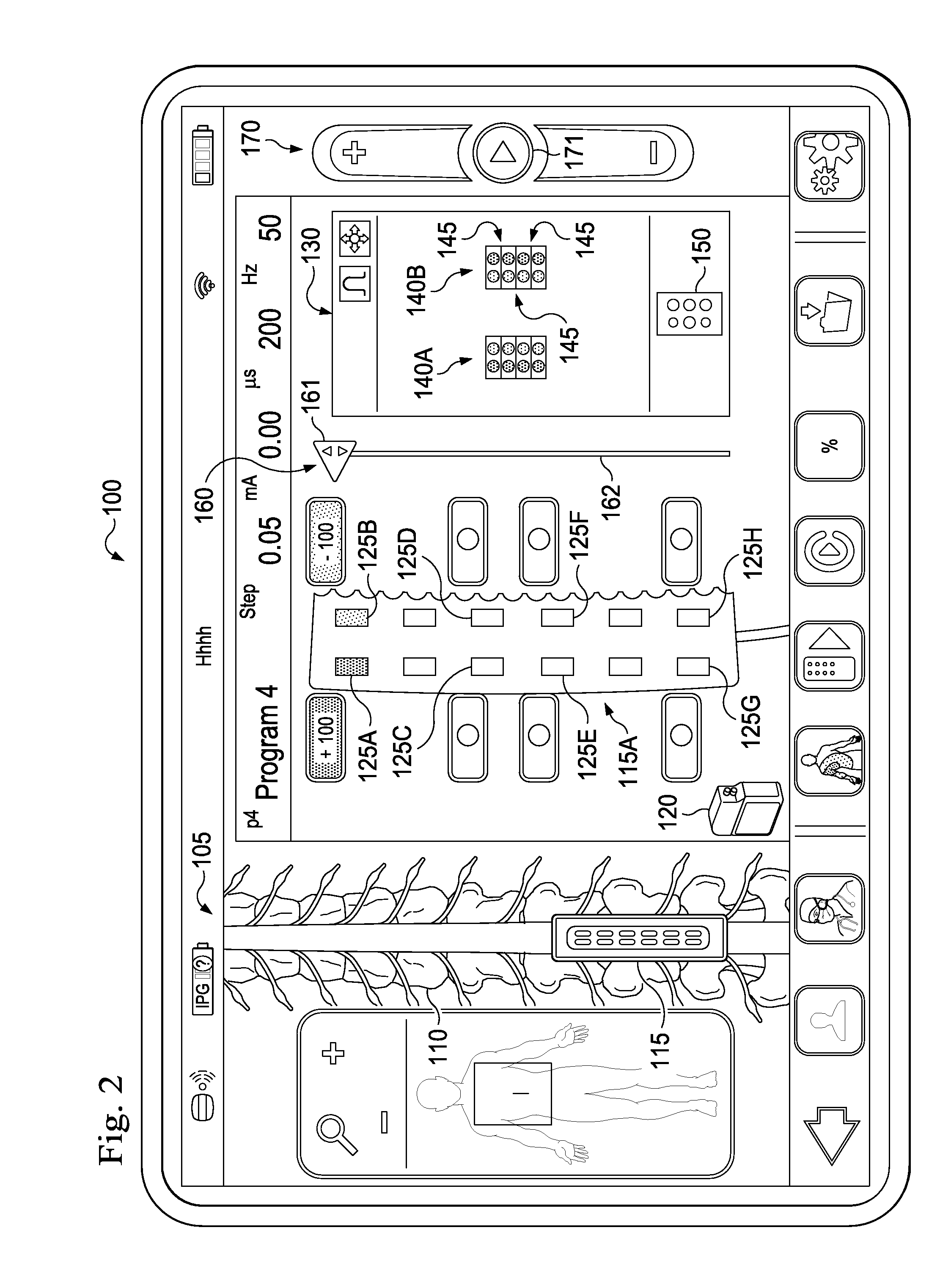 Method and System of Quick Neurostimulation Electrode Configuration and Positioning