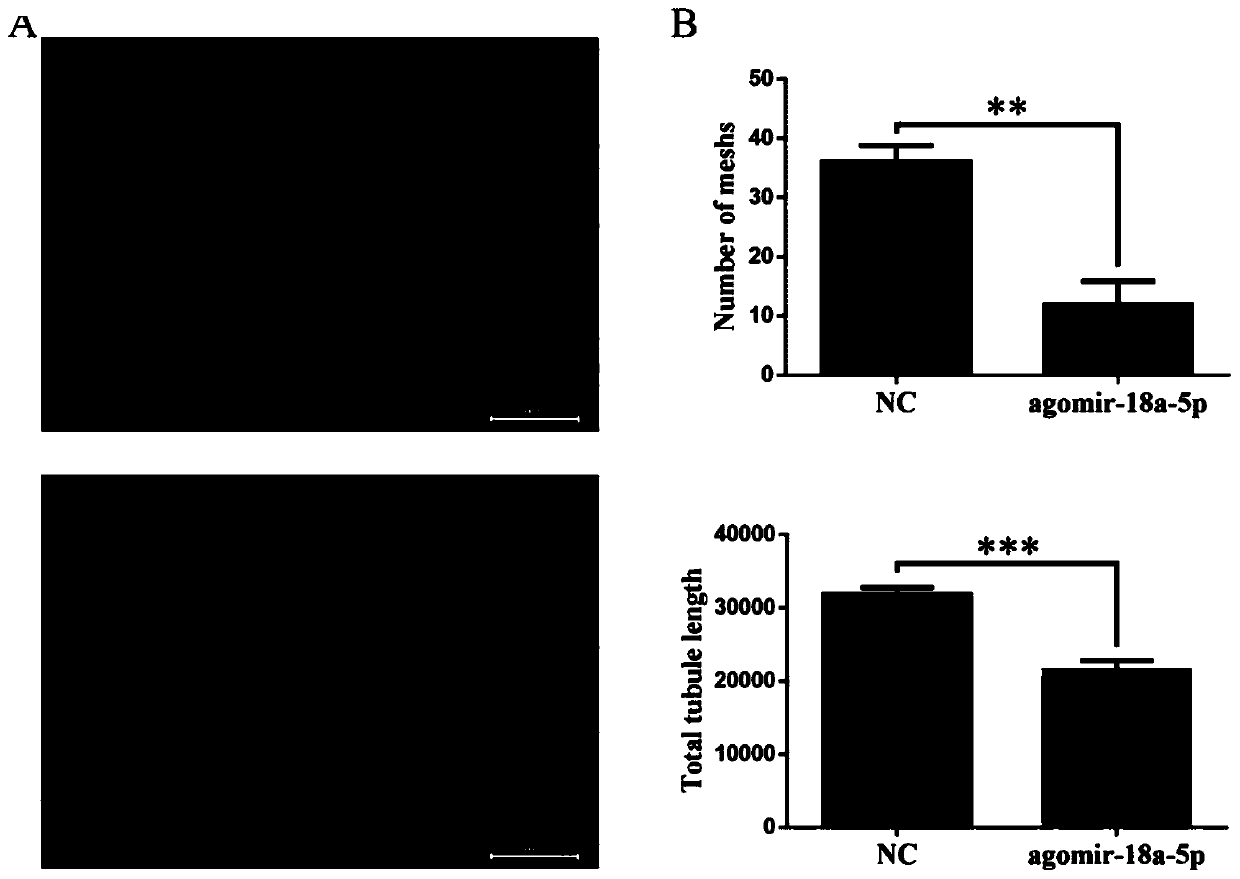 Application of miR-18a-5p agonist in preparing anti-retinal neovascularization drugs