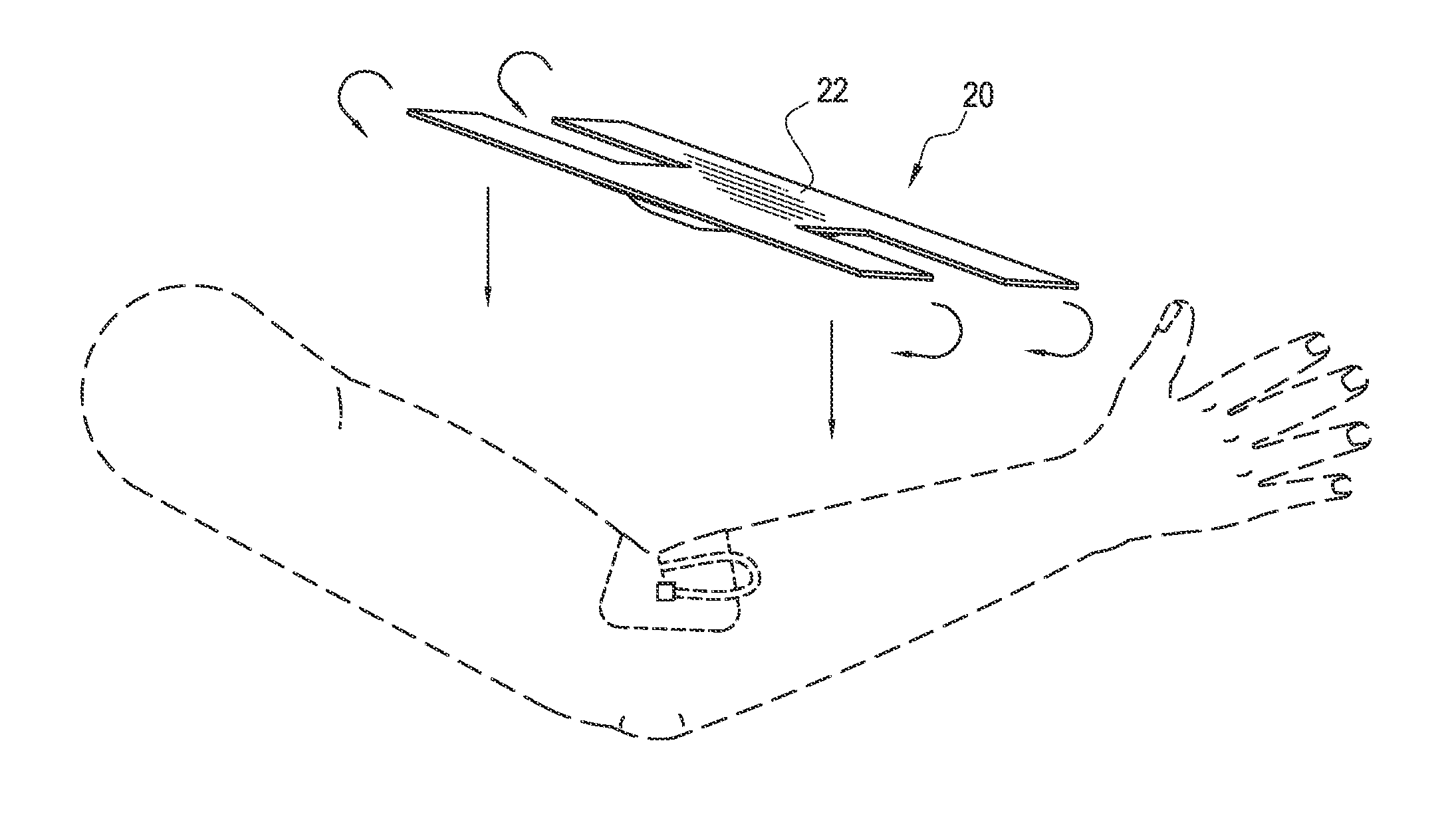Intravenous splint cover and associated methods