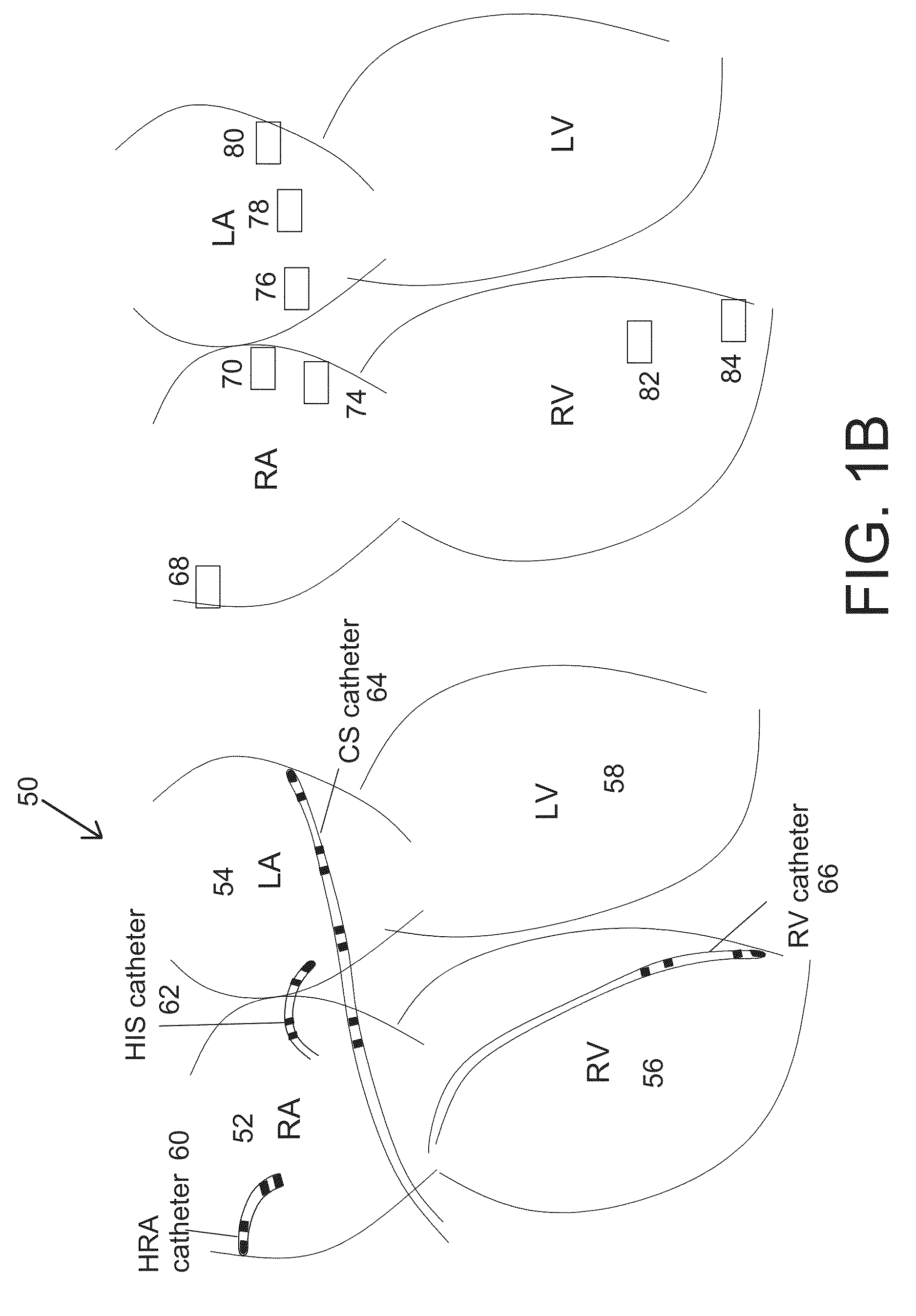 Methods and system for real-time cardiac mapping