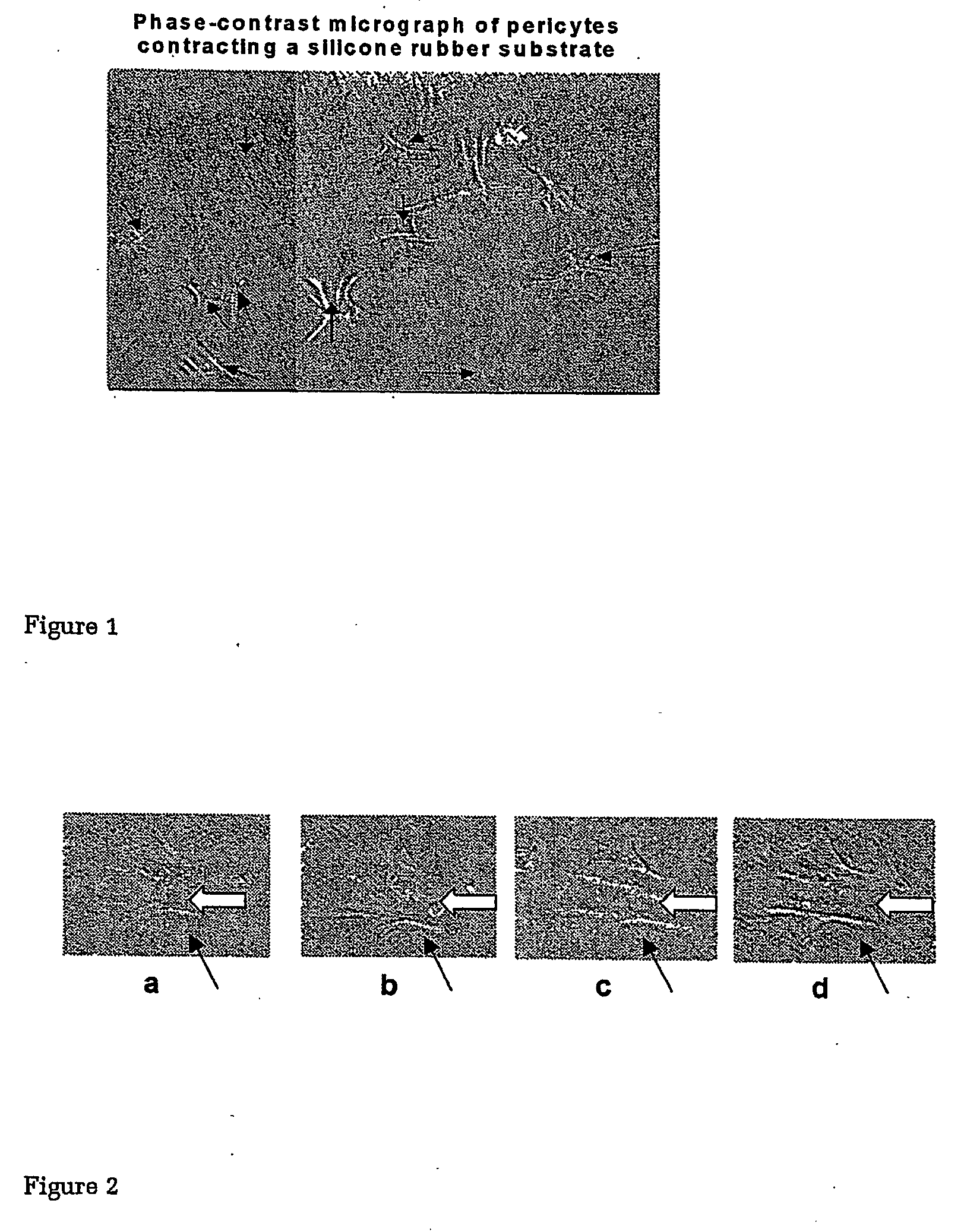 Novel screens to identify agents that modulate retinal blood vessel function and pericyte function and diagnostic and therapeutic application therefor