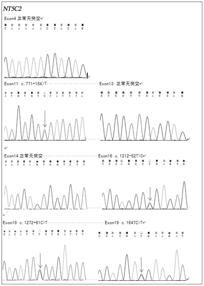 Relapse and drug resistance gene mutation detection kit and application method of acute lymphoblastic leukemia