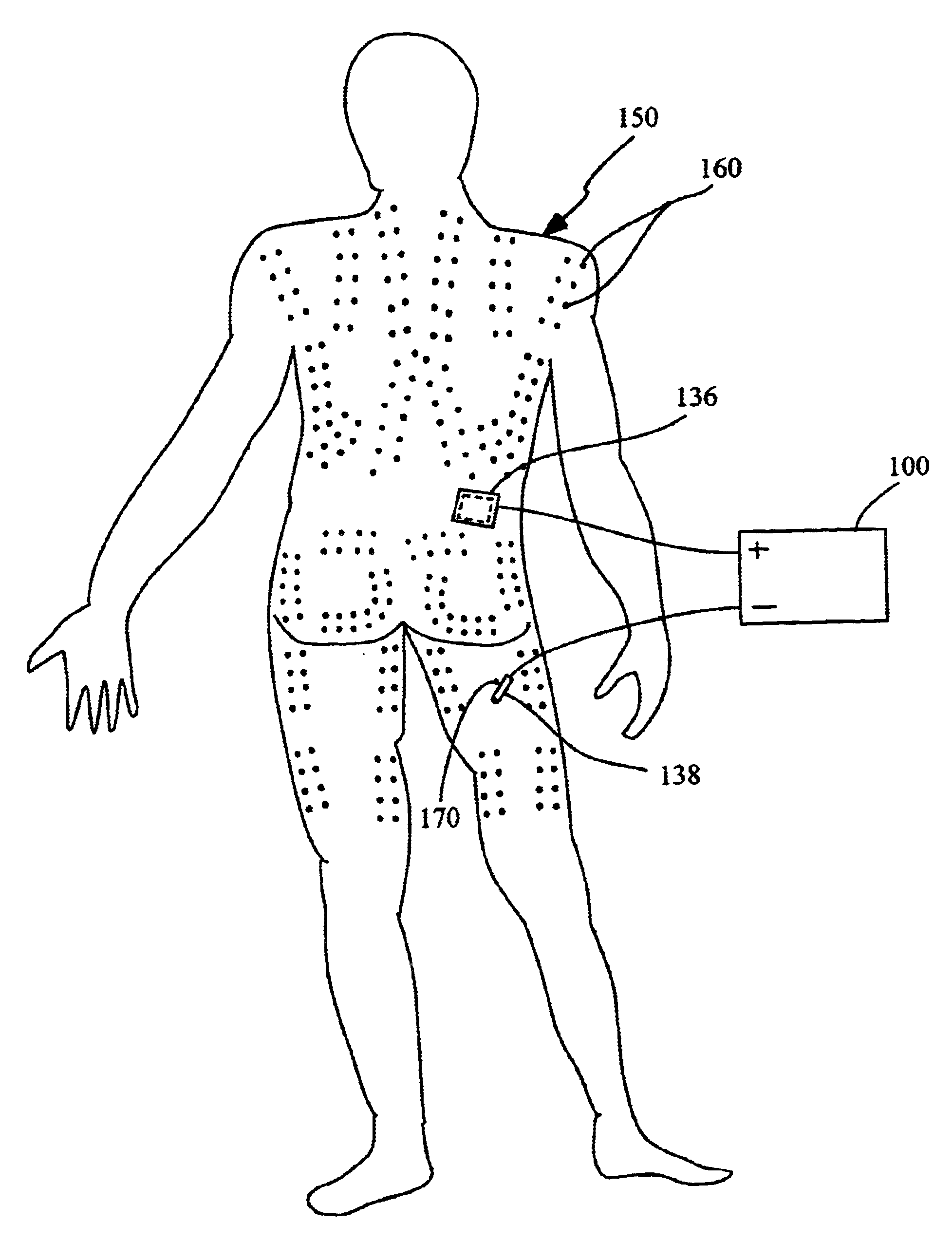 Method and device for electrochemically building of muscle