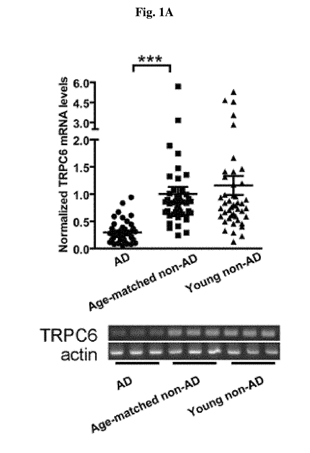 Use of trpc6 mRNA levels in peripheral blood cells for early detection/diagnosis of senile dementia