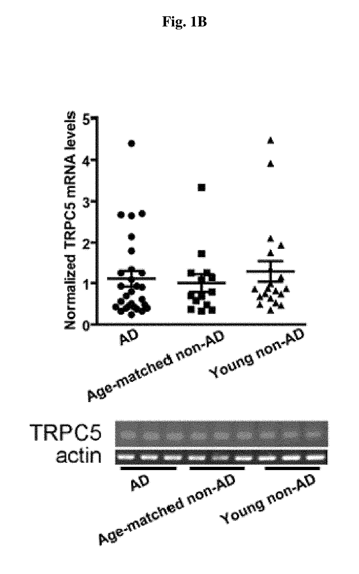 Use of trpc6 mRNA levels in peripheral blood cells for early detection/diagnosis of senile dementia