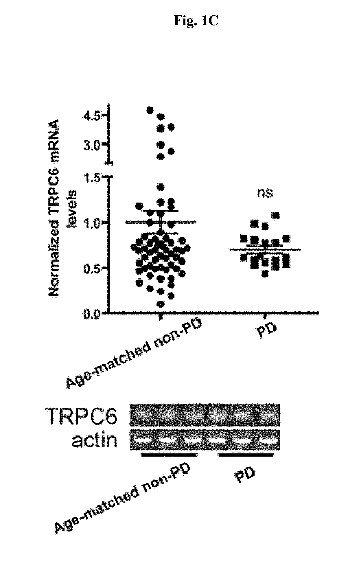 Use of trpc6 mRNA levels in peripheral blood cells for early detection/diagnosis of senile dementia