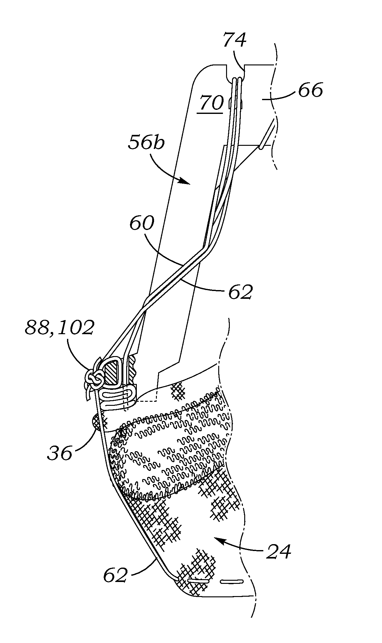 Holder and deployment system for surgical heart valves