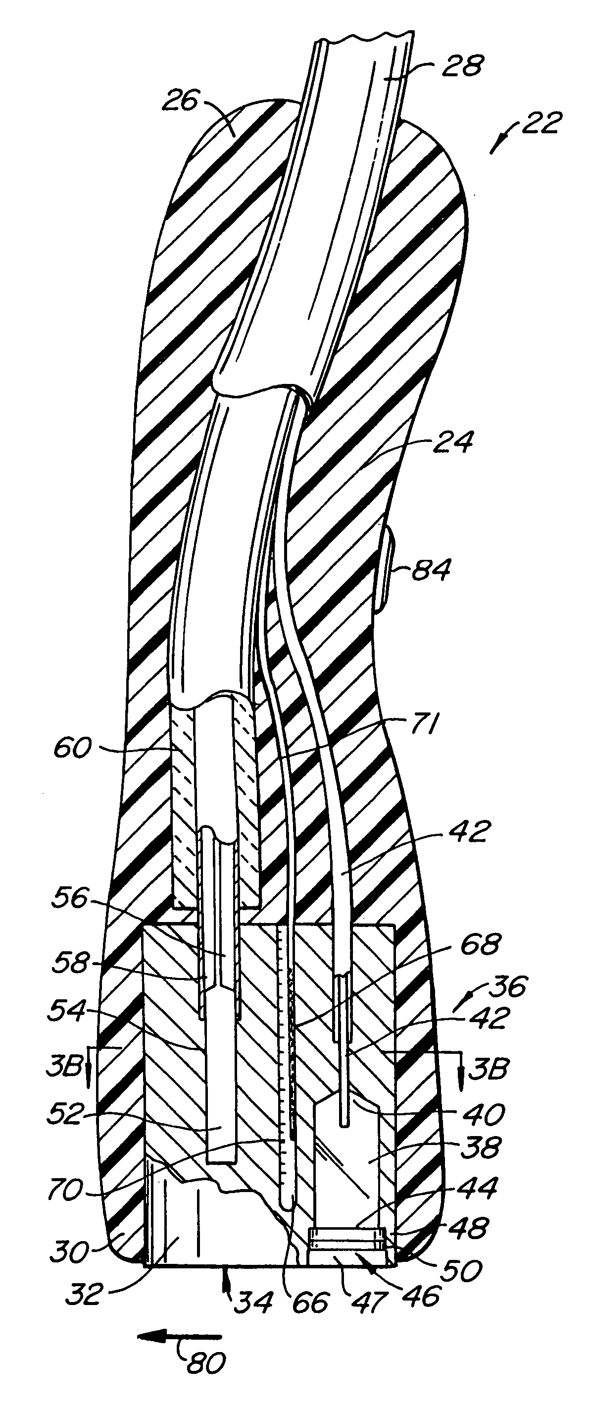 Tissue treatment device and method