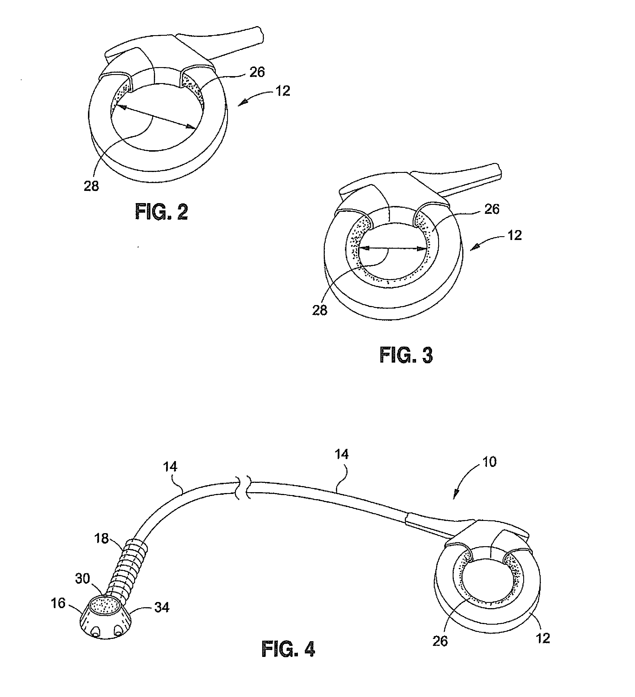 Over molded implantable device to protect tubing from puncture