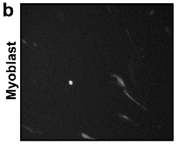 Modification of the dystrophin gene and uses thereof