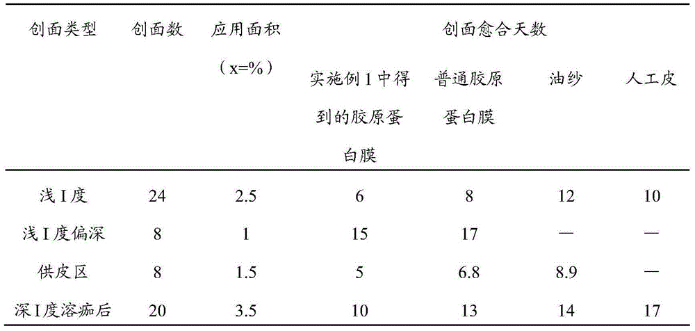 Collagen membrane and preparation method thereof