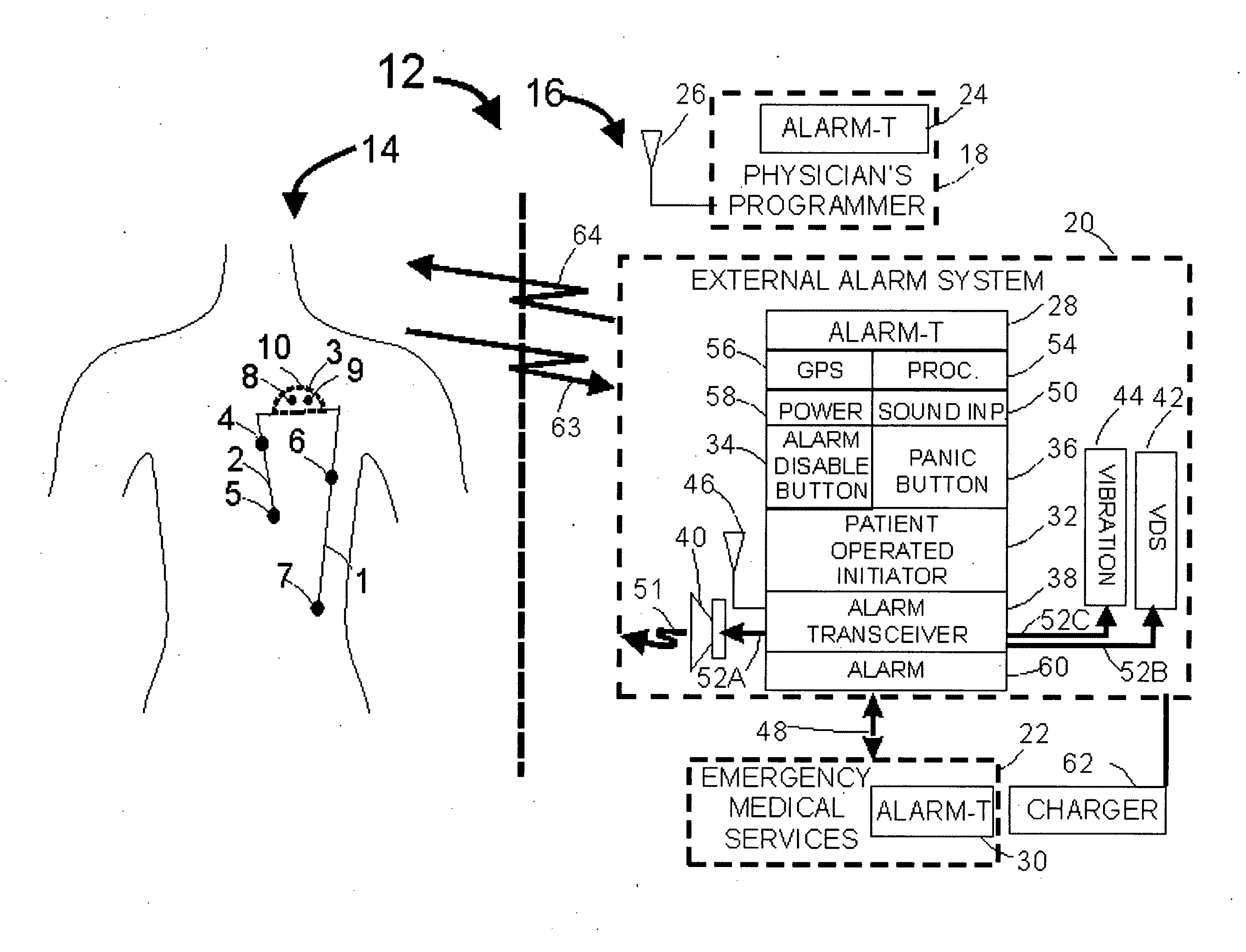 Systems and methods of alarm validation and backup in implanted medical devices