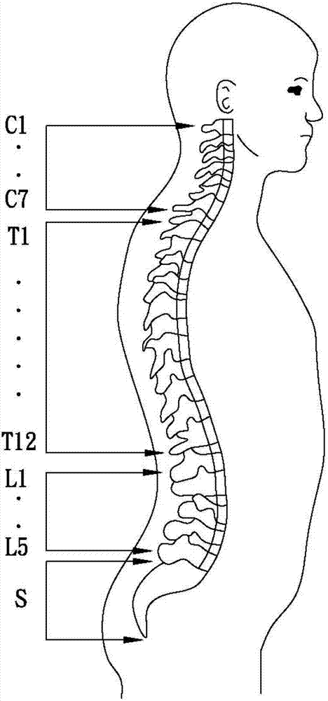 Portable spinal orthotic backrest