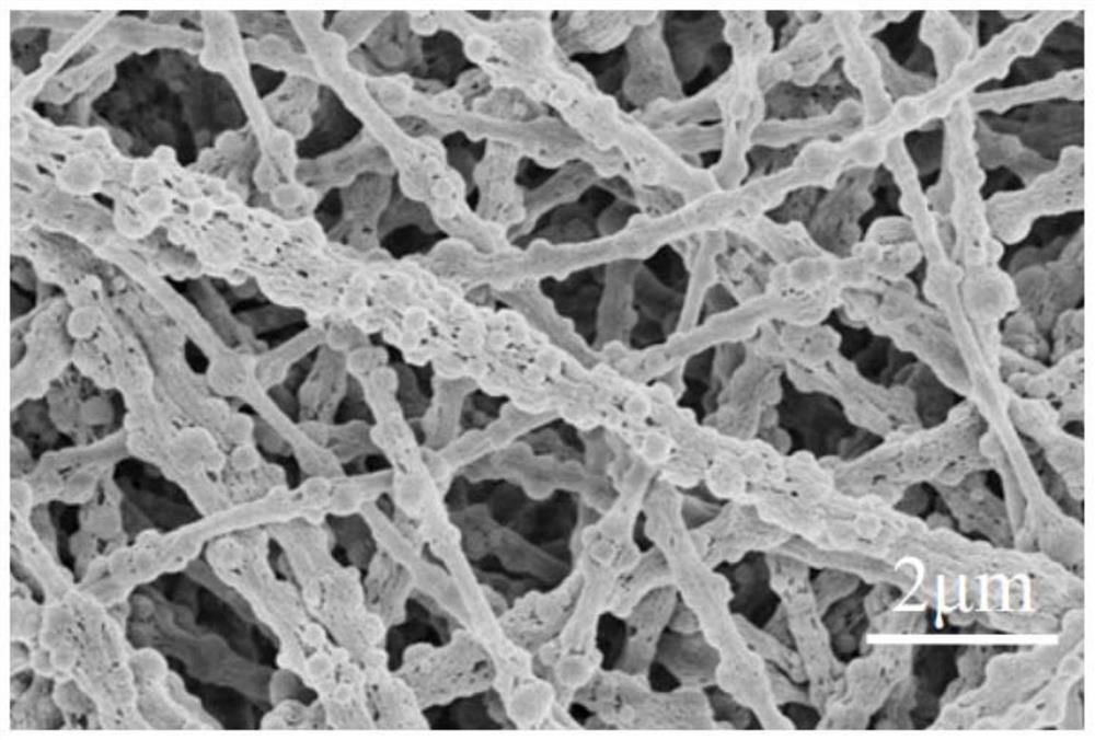Dialysis/adsorption difunctional nanofiber composite-based hemodialysis membrane and preparation method thereof
