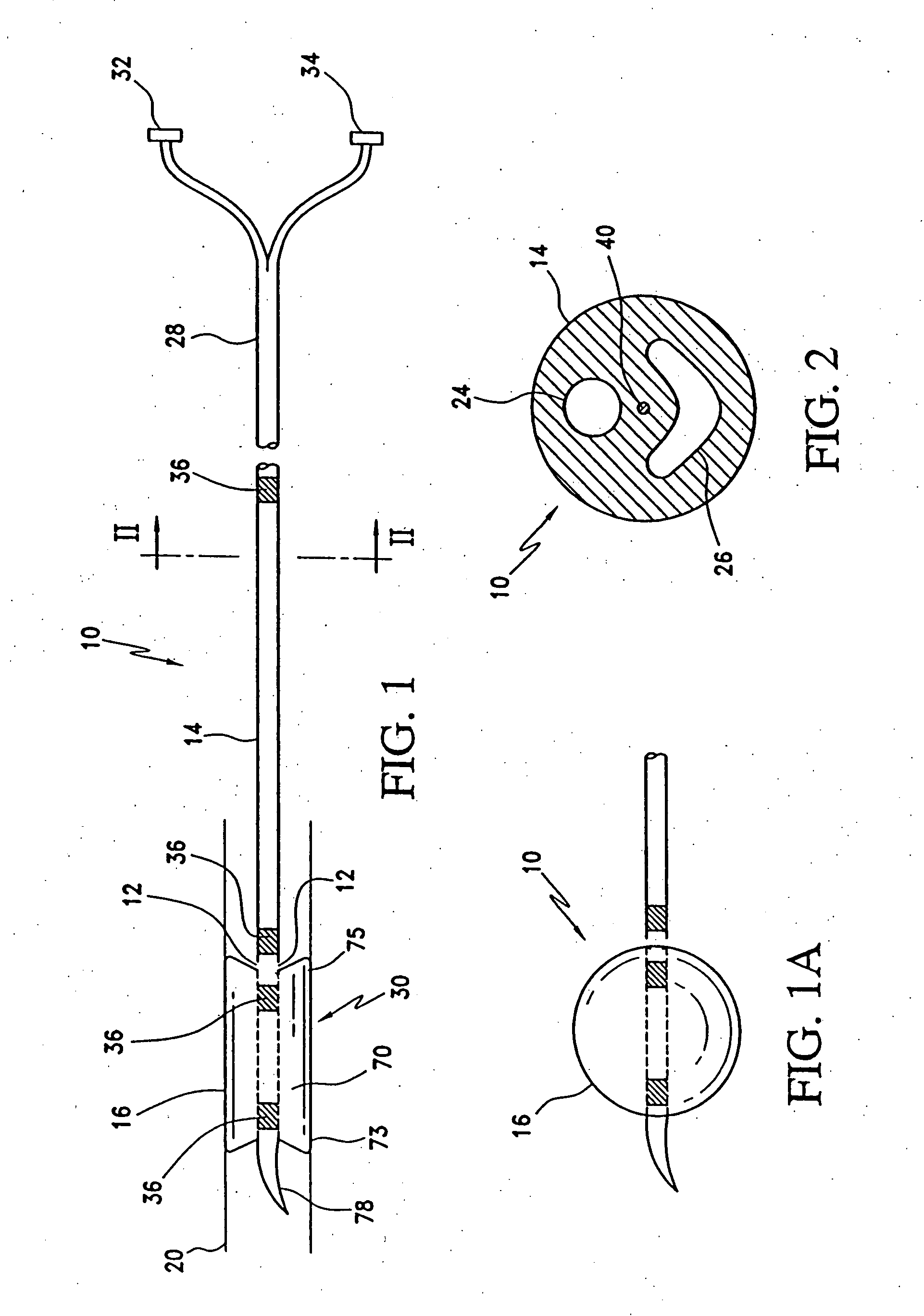 Method and apparatus for treatment of thrombosed hemodialysis access grafts and arterio venous fistulas