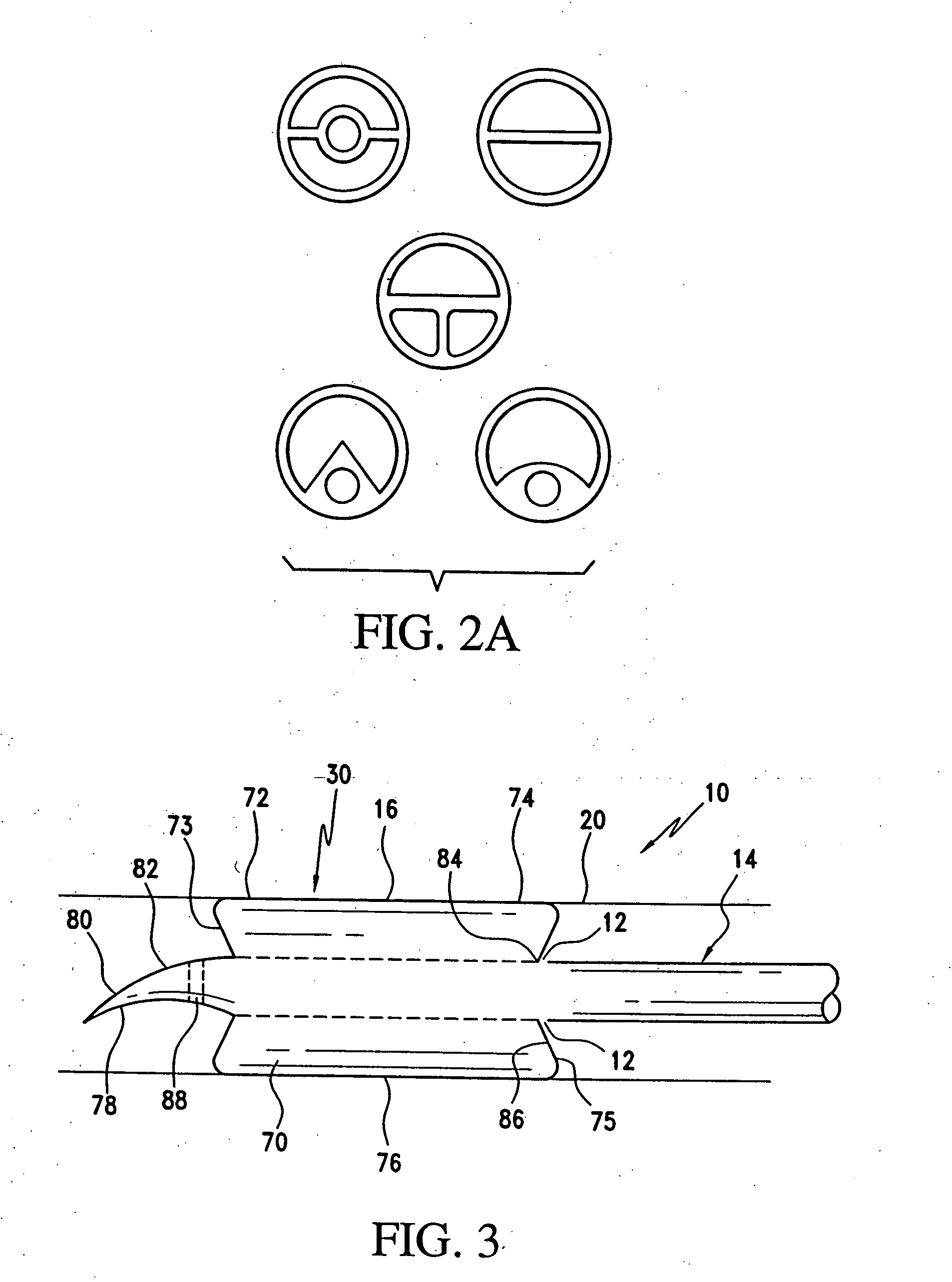 Method and apparatus for treatment of thrombosed hemodialysis access grafts and arterio venous fistulas