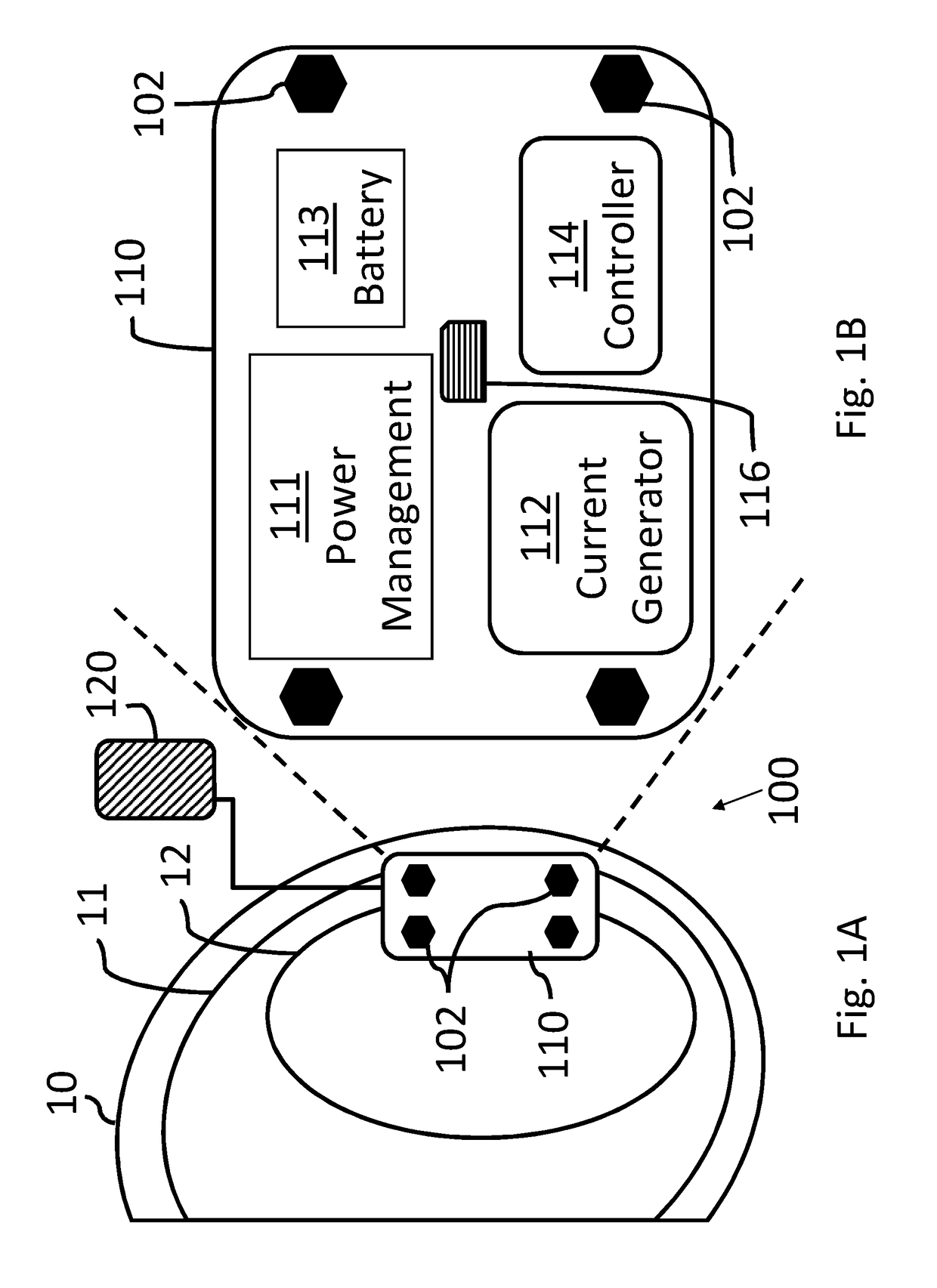 System and method for detecting contractions