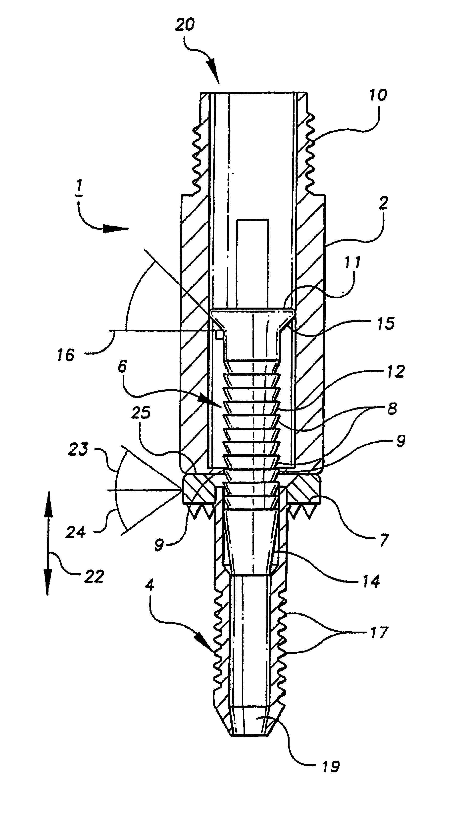 Bone anchor and deployment device therefor
