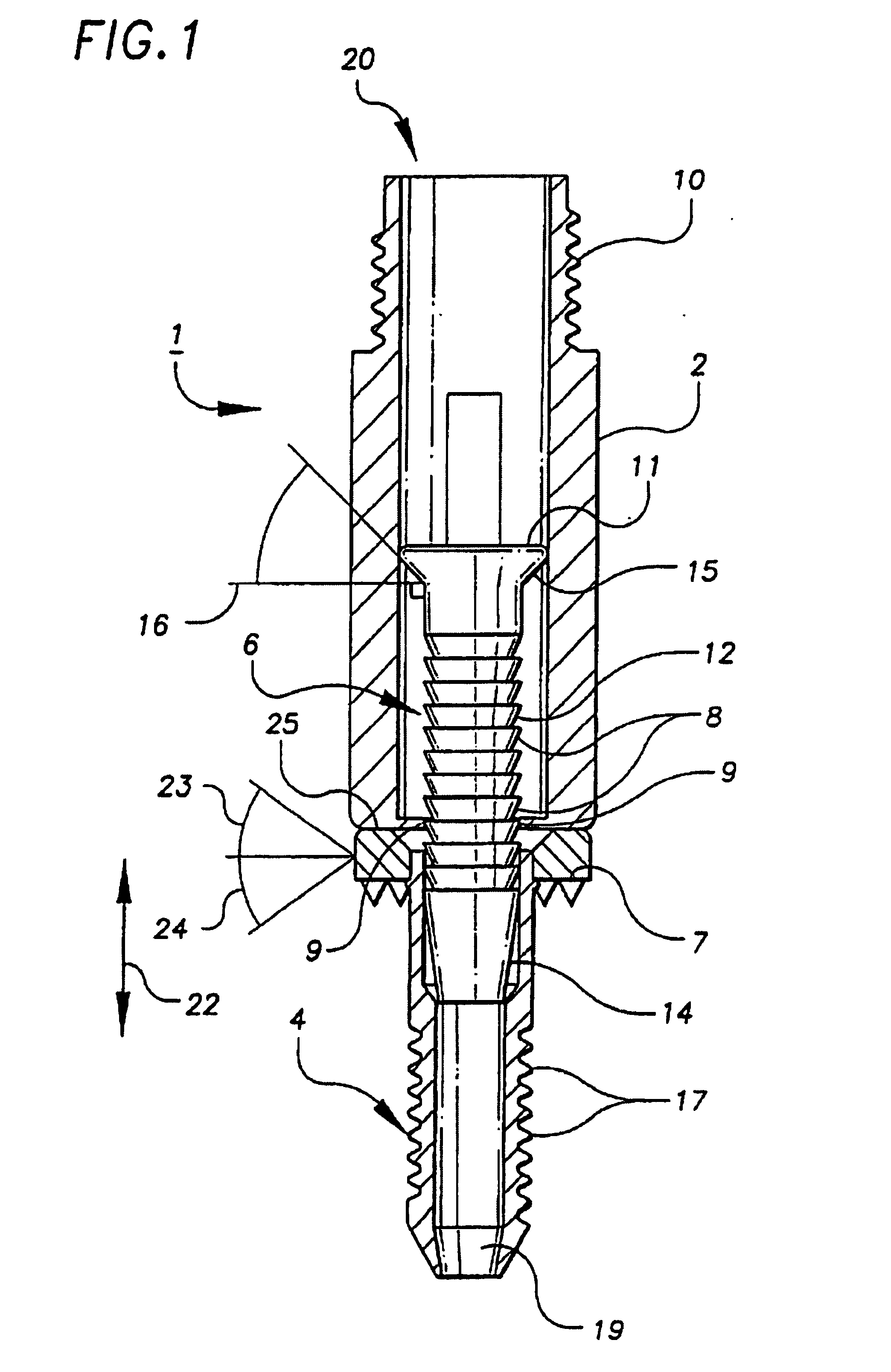 Bone anchor and deployment device therefor