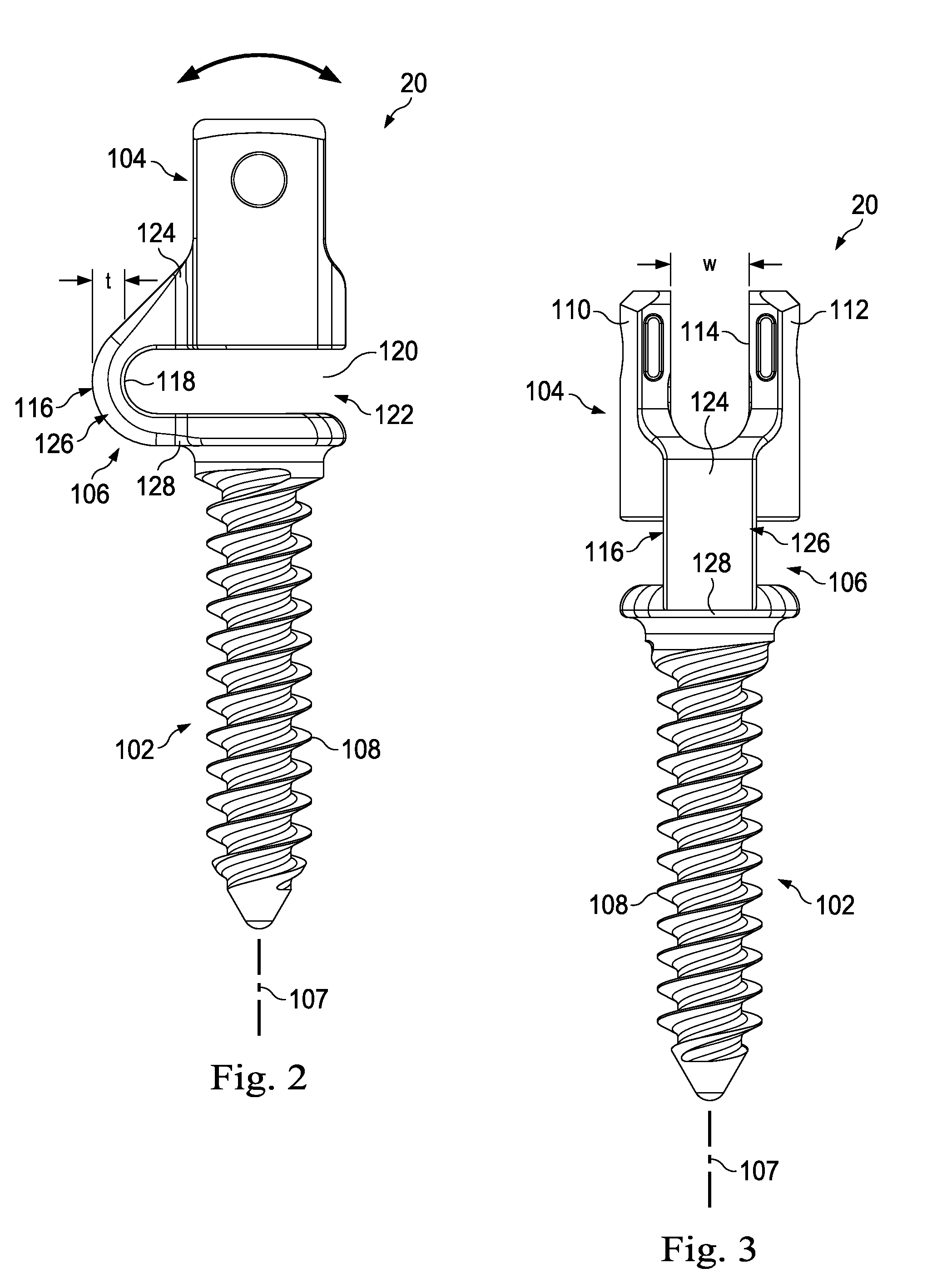 Spinal constructs with improved load-sharing