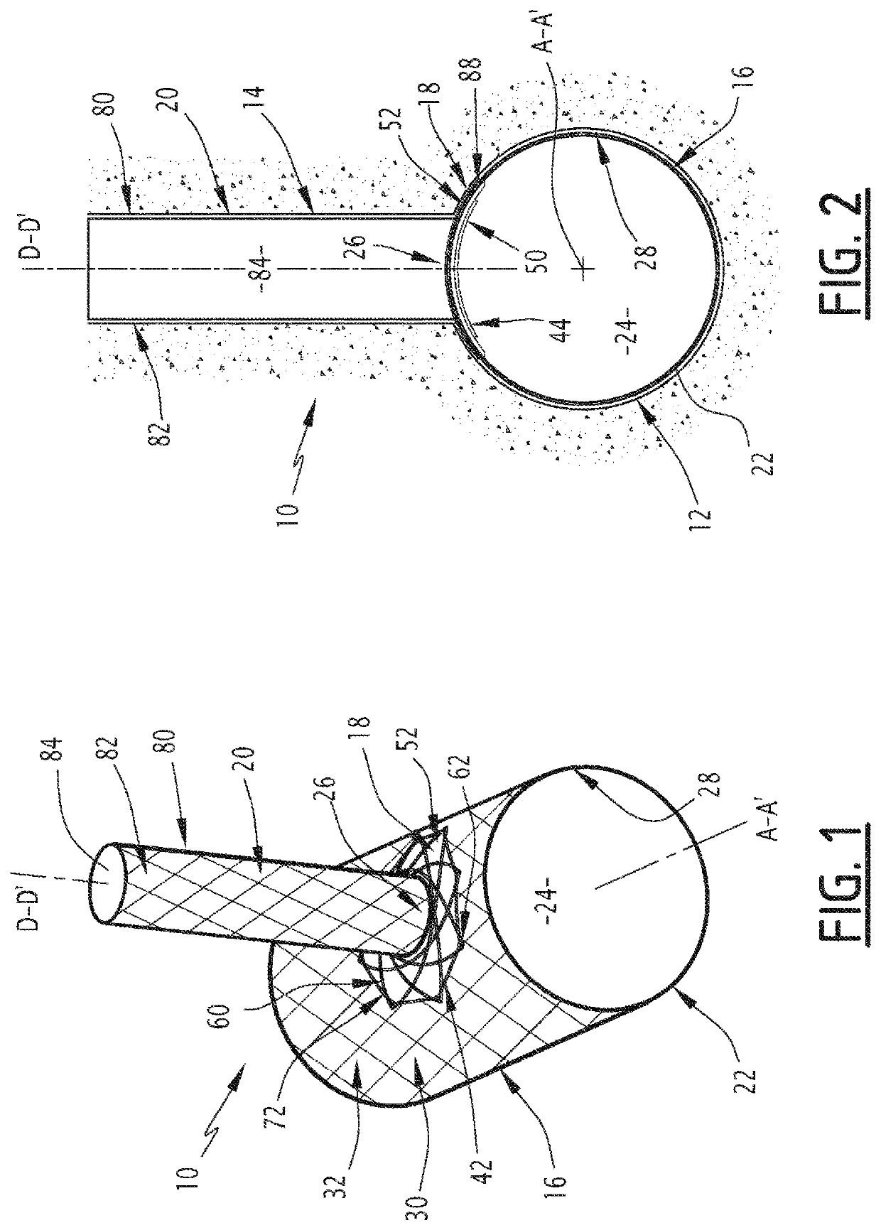 Elastic ring and associated treatment device for implanting in a conduit for circulation of a body fluid