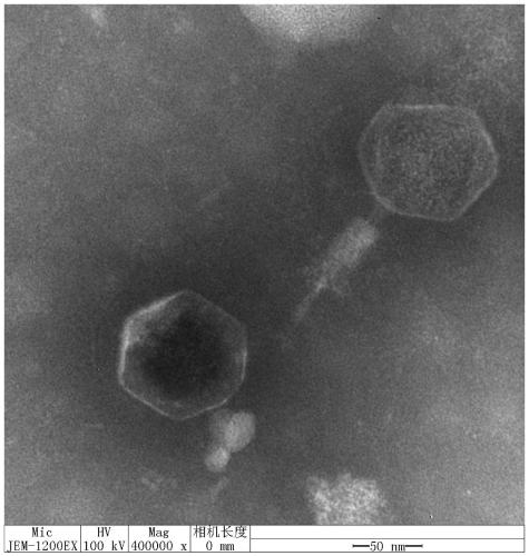 Alkali-resistant vibrio alginolyticus phage and composition thereof and kit, and application thereof