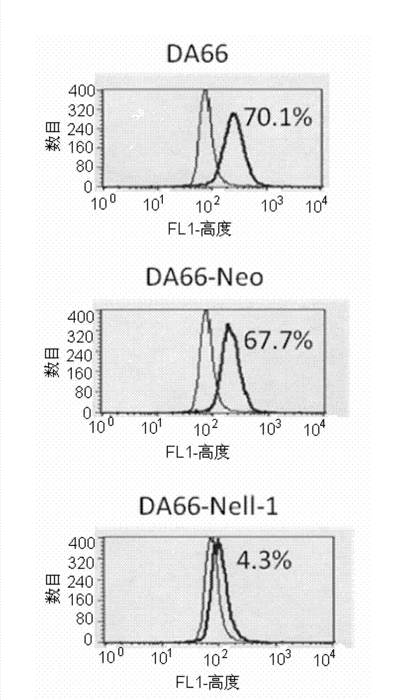 Gene medicine for promoting differentiation of tumor stem cells and applications thereof