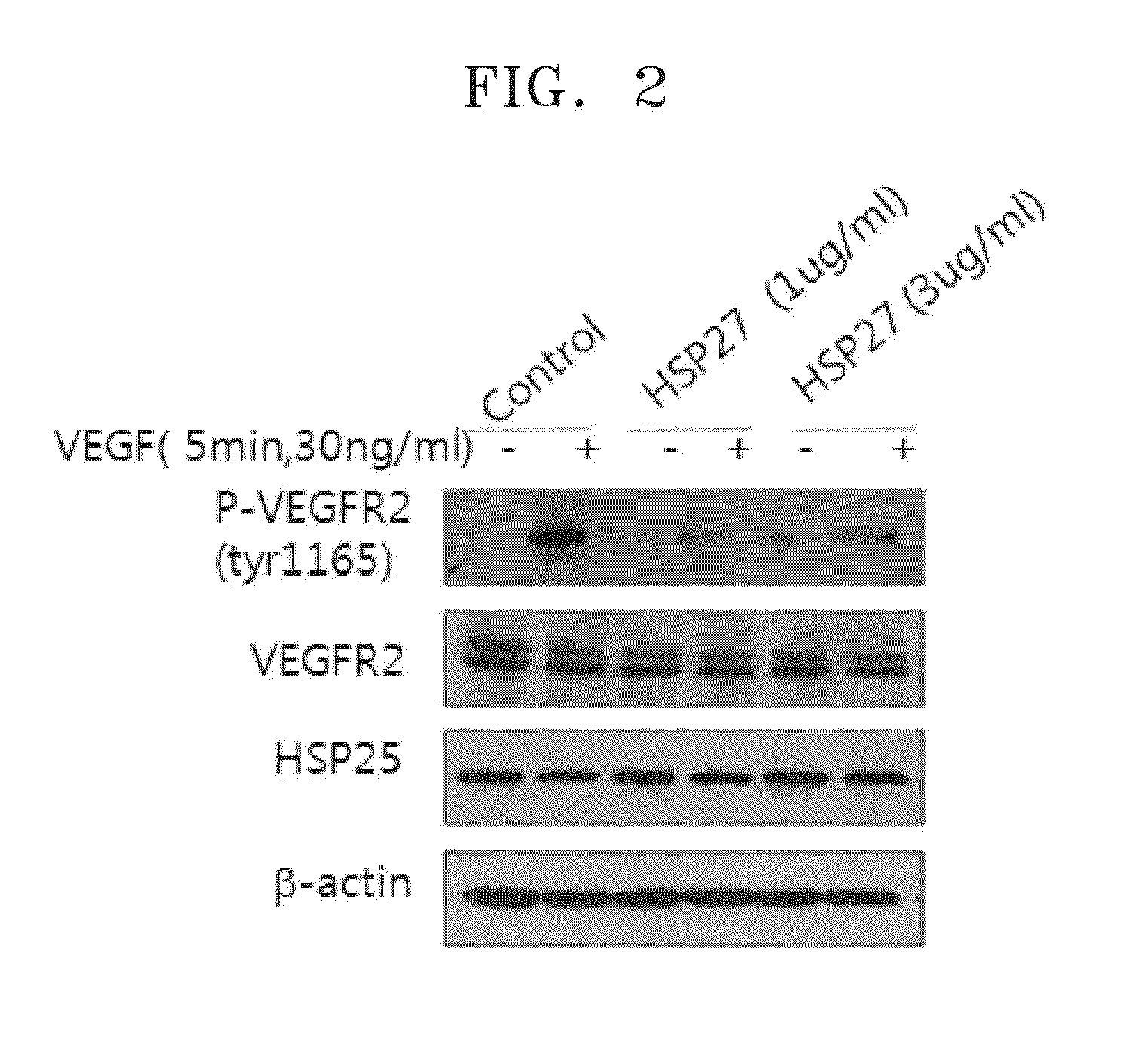 Pharmaceutical composition for promoting angiogenesis, and method for screening for active substances for promoting angiogenesis
