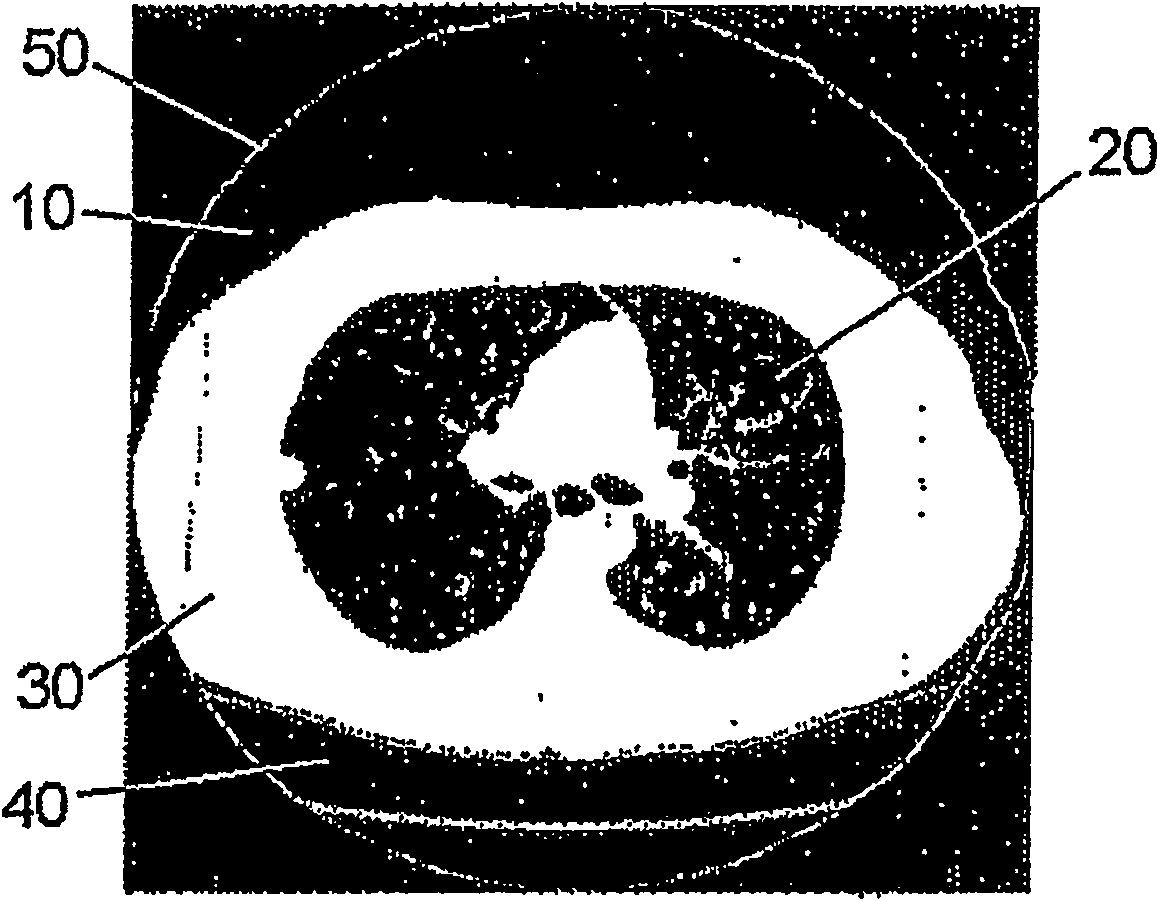 Method and device for forming an isolated visualization of body structures